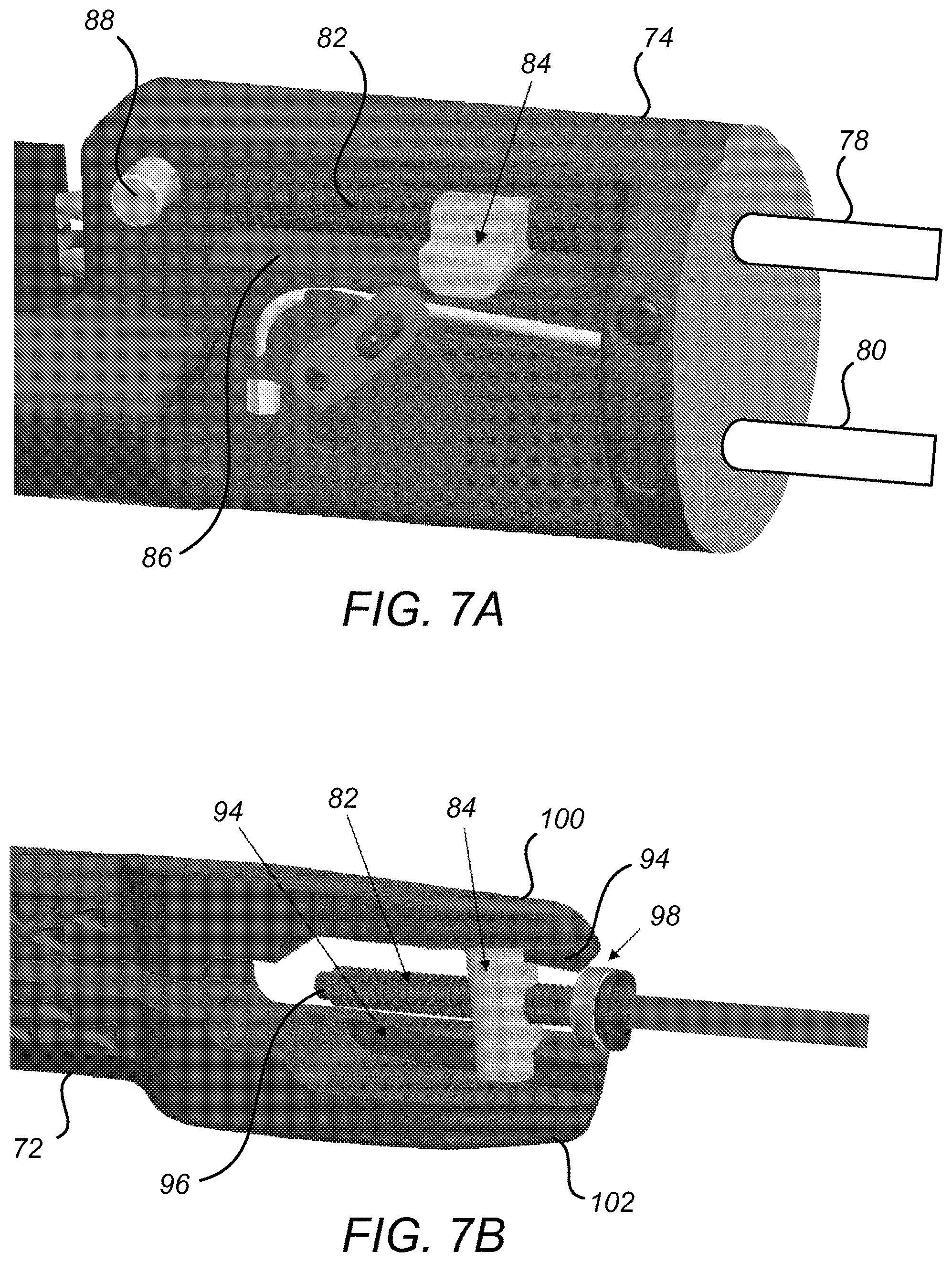 Patent US11793519 Figure 7 – Methods and systems for detecting staple cartridge misfire or failure