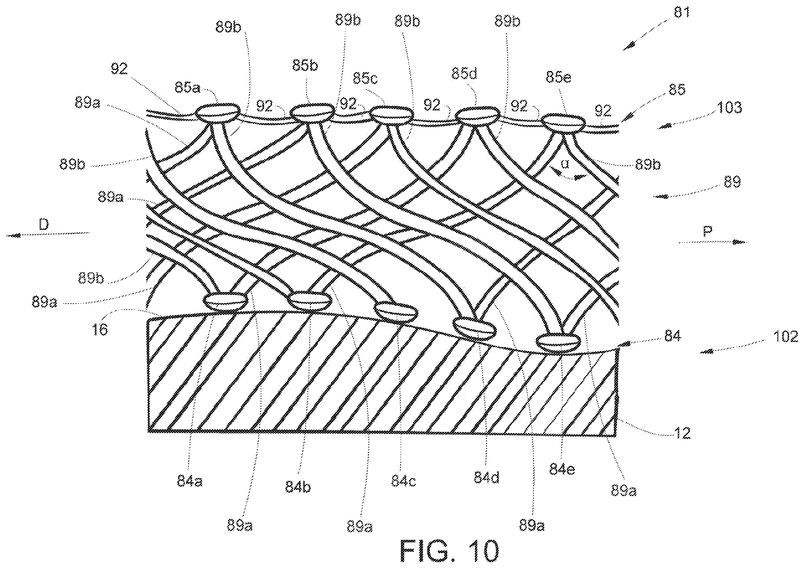 Patent US11793522 Figure 10 – Staple cartridge assembly including a compressible adjunct