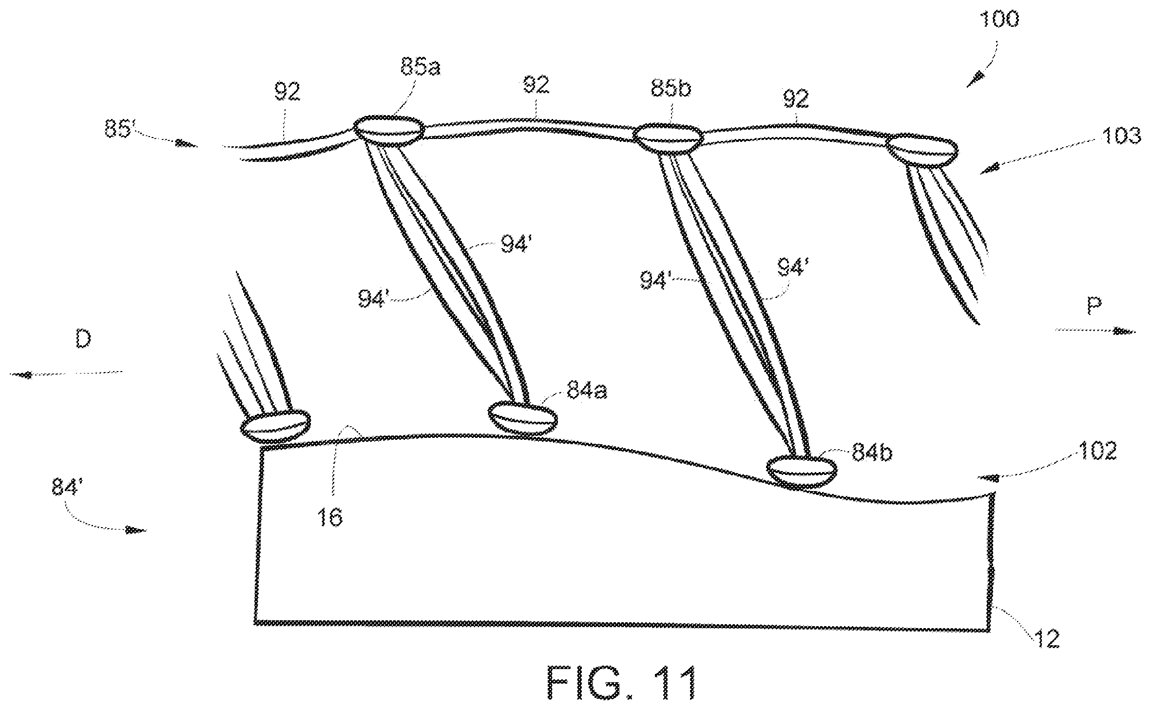Patent US11793522 Figure 11 – Staple cartridge assembly including a compressible adjunct