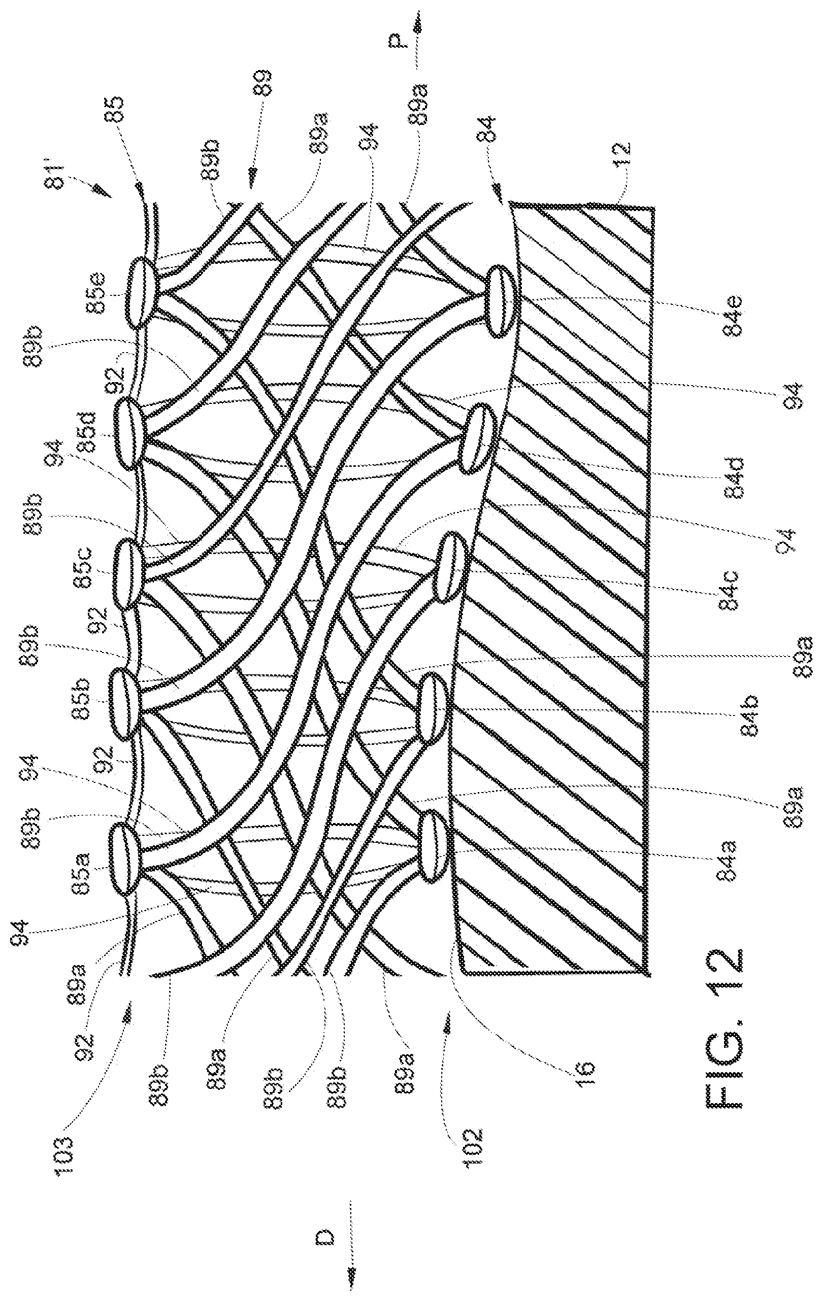 Patent US11793522 Figure 12 – Staple cartridge assembly including a compressible adjunct