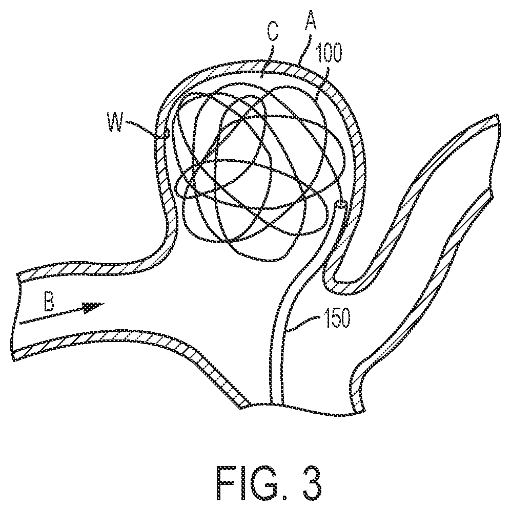 Patent US11793523 Figure 3 – Aneurysm treatment coils and associated systems and methods of use