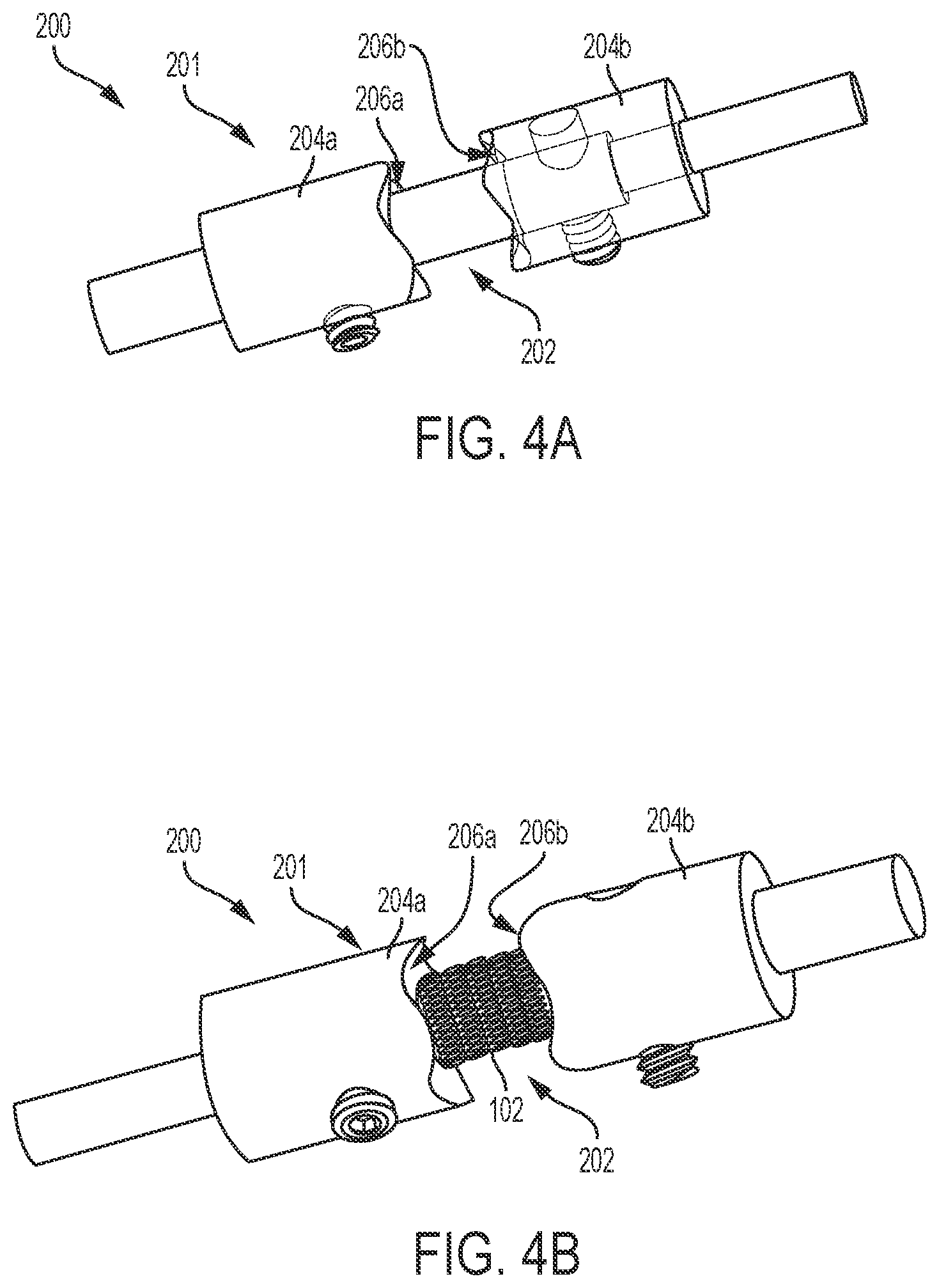Patent US11793523 Figure 4 – Aneurysm treatment coils and associated systems and methods of use