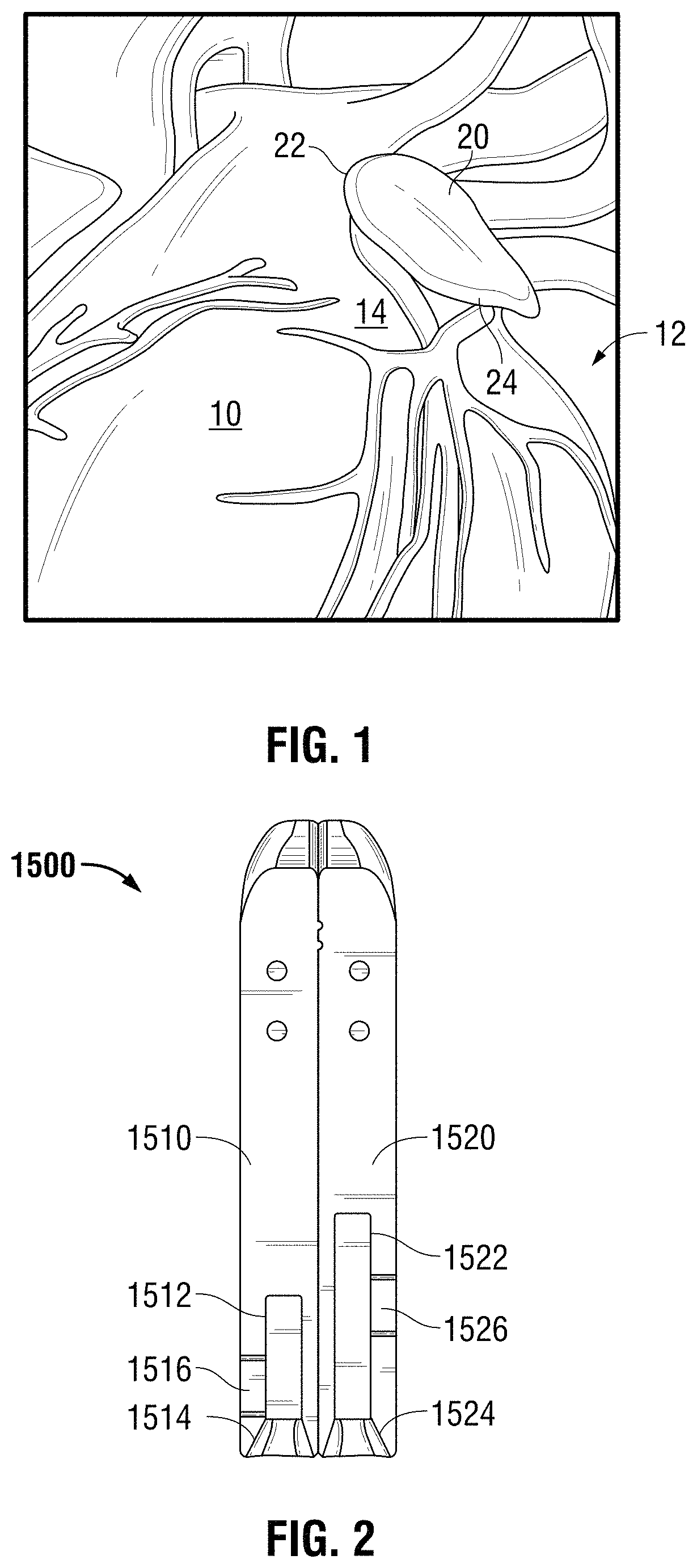 Patent US11793524 Figure 1 – Recapturable left atrial appendage clipping device and methods for recapturing a left atrial appendage clip