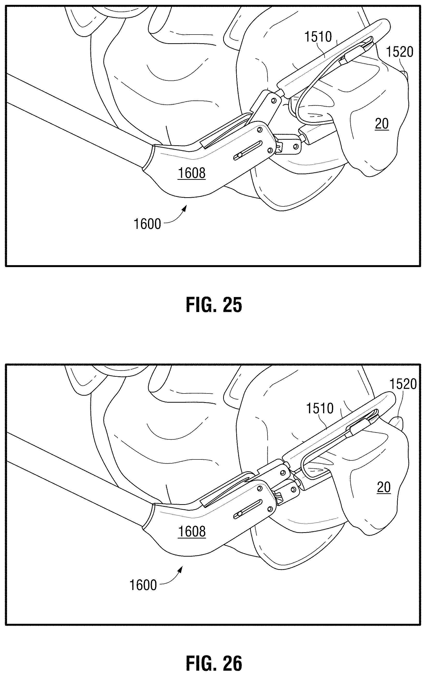 Patent US11793524 Figure 13 – Recapturable left atrial appendage clipping device and methods for recapturing a left atrial appendage clip