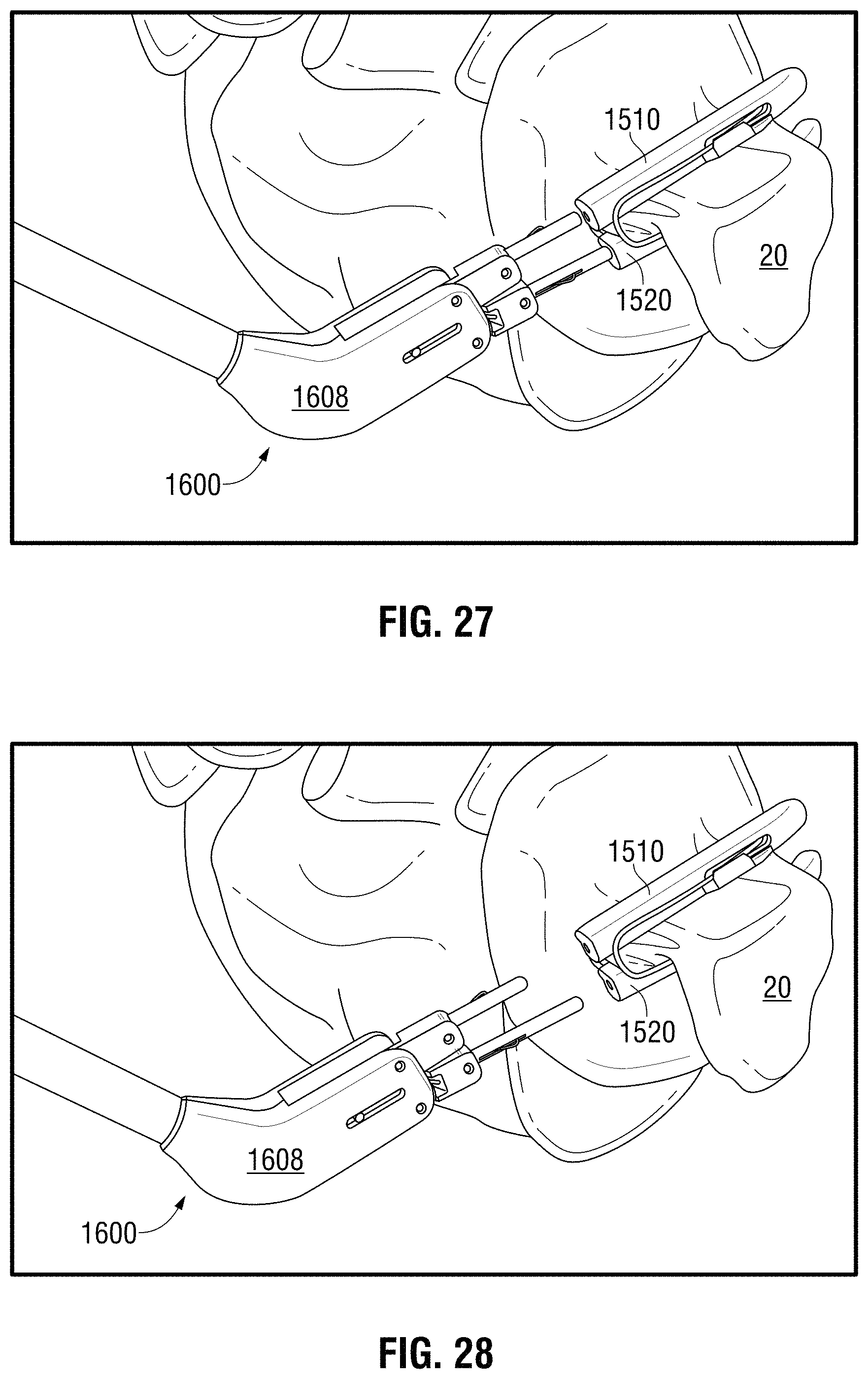 Patent US11793524 Figure 14 – Recapturable left atrial appendage clipping device and methods for recapturing a left atrial appendage clip