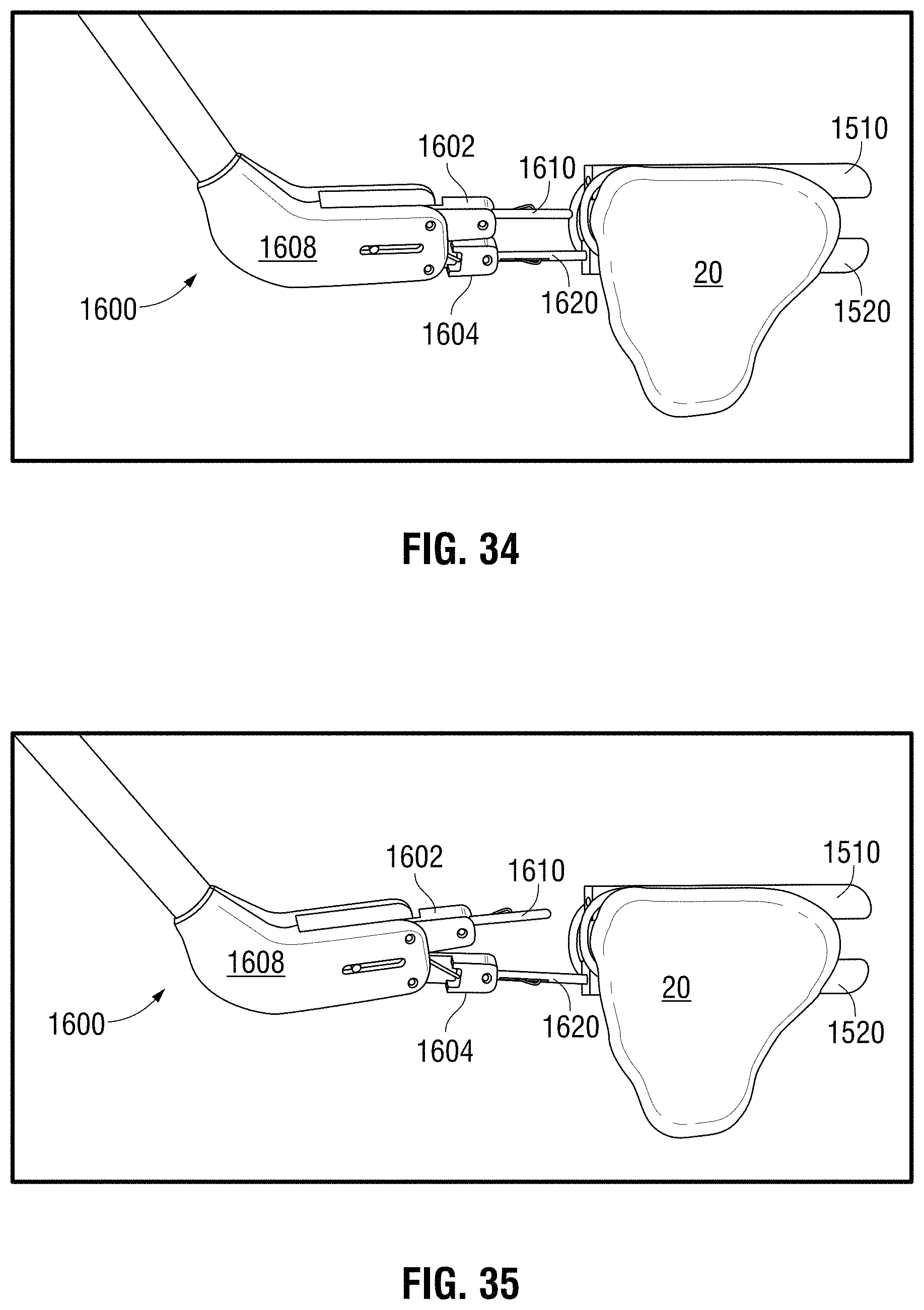 Patent US11793524 Figure 16 – Recapturable left atrial appendage clipping device and methods for recapturing a left atrial appendage clip
