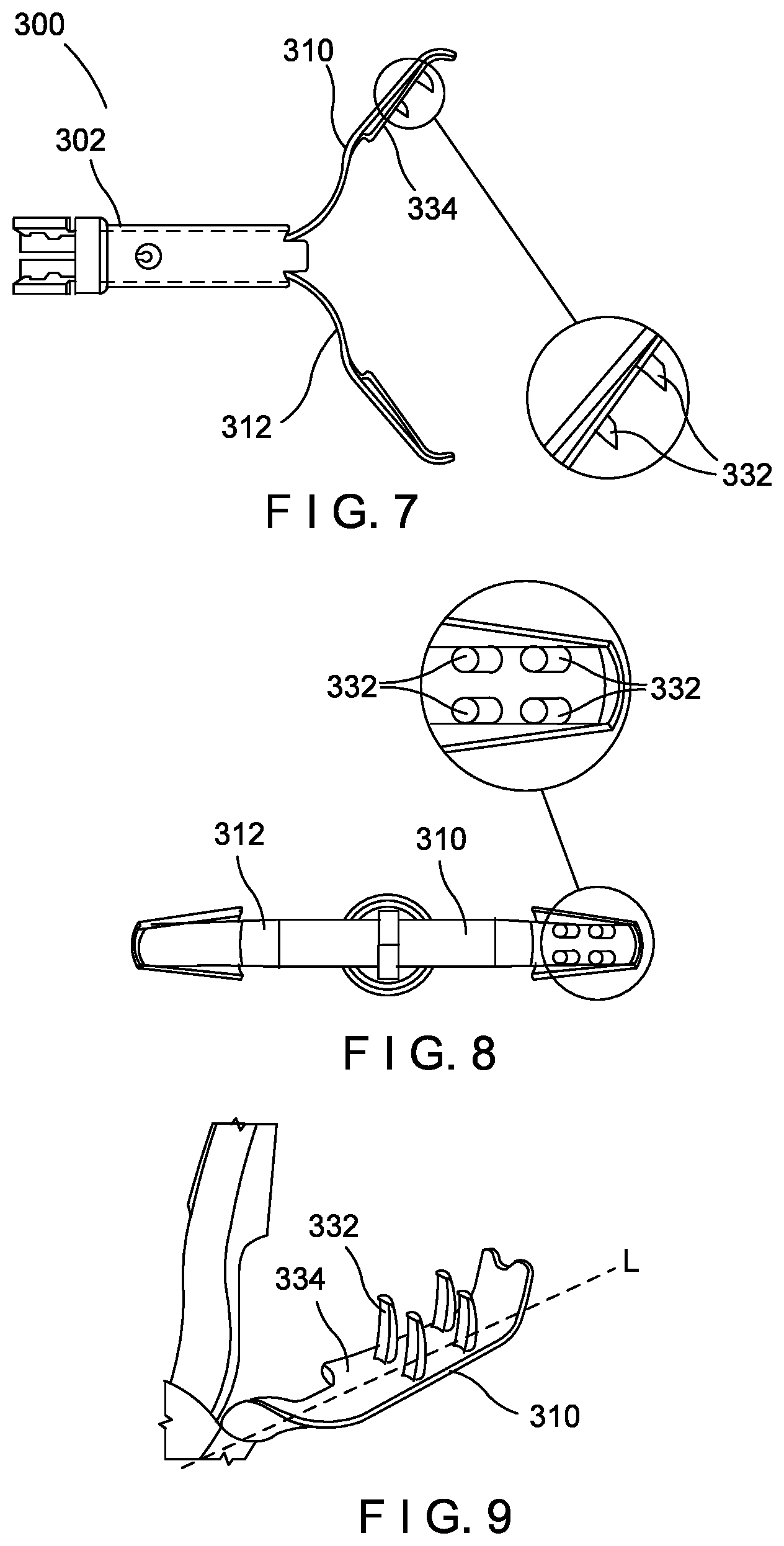 Patent US11793525 Figure 3 – Aggressive featured clips with improved tissue retention