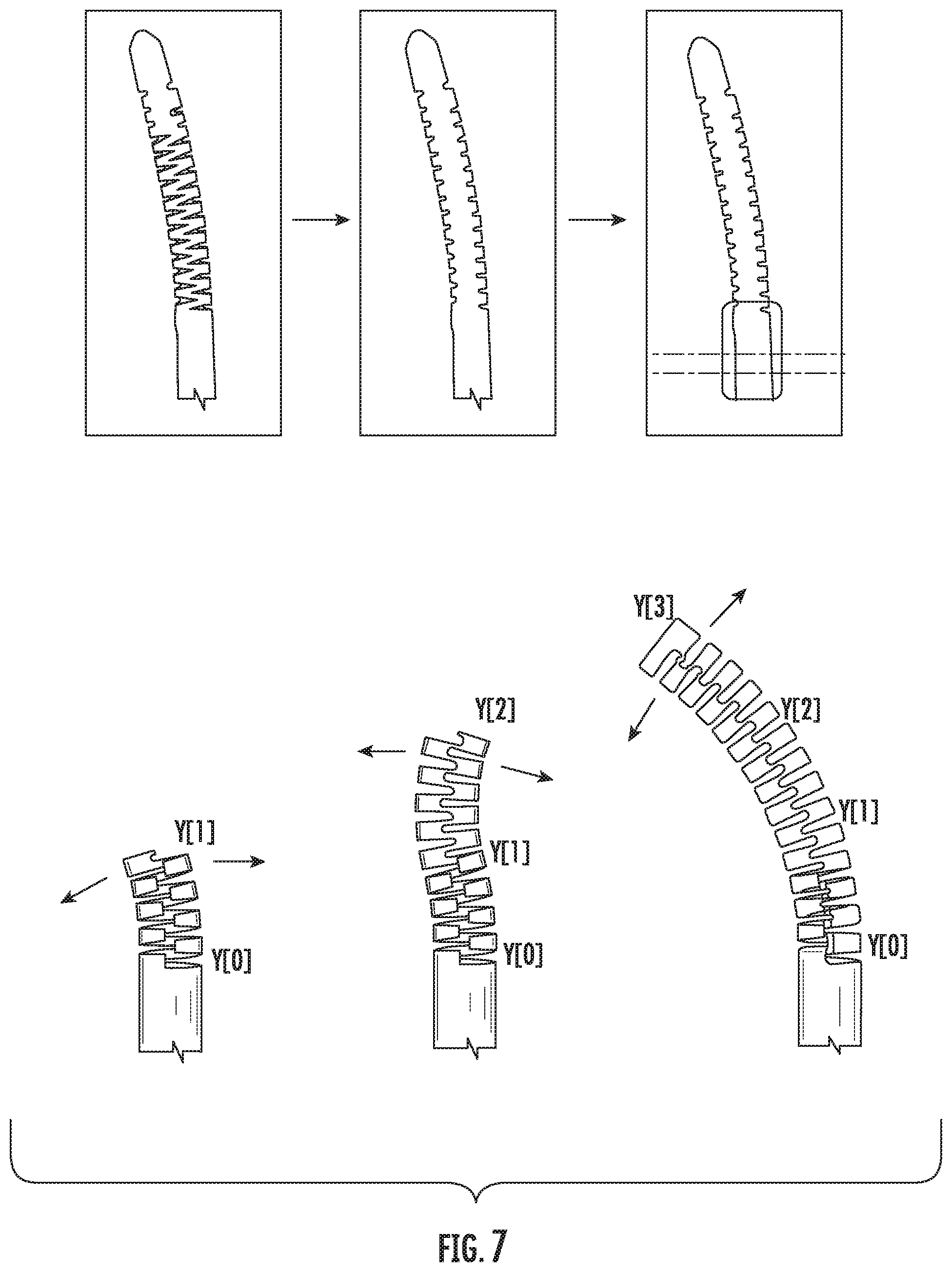 Patent US11793526 Figure 6 – Steerable drill for minimally-invasive surgery