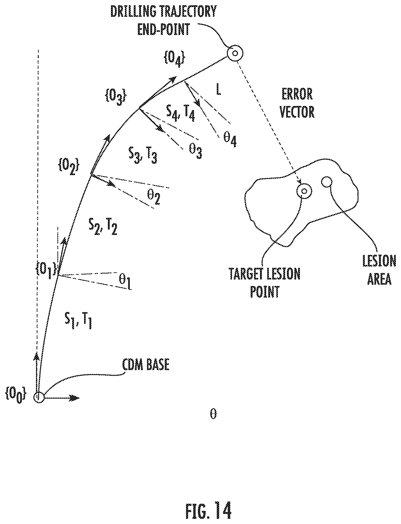 Patent US11793526 Figure 10 – Steerable drill for minimally-invasive surgery
