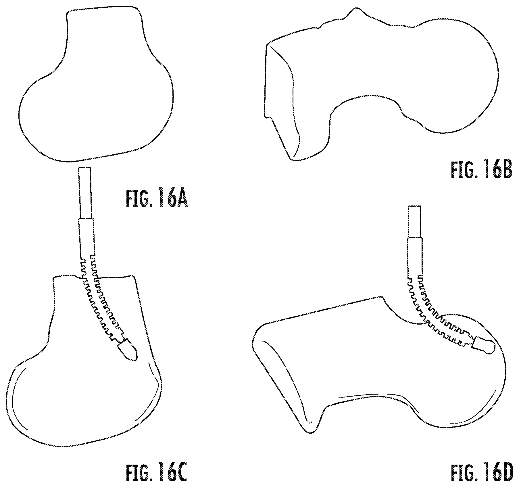 Patent US11793526 Figure 12 – Steerable drill for minimally-invasive surgery