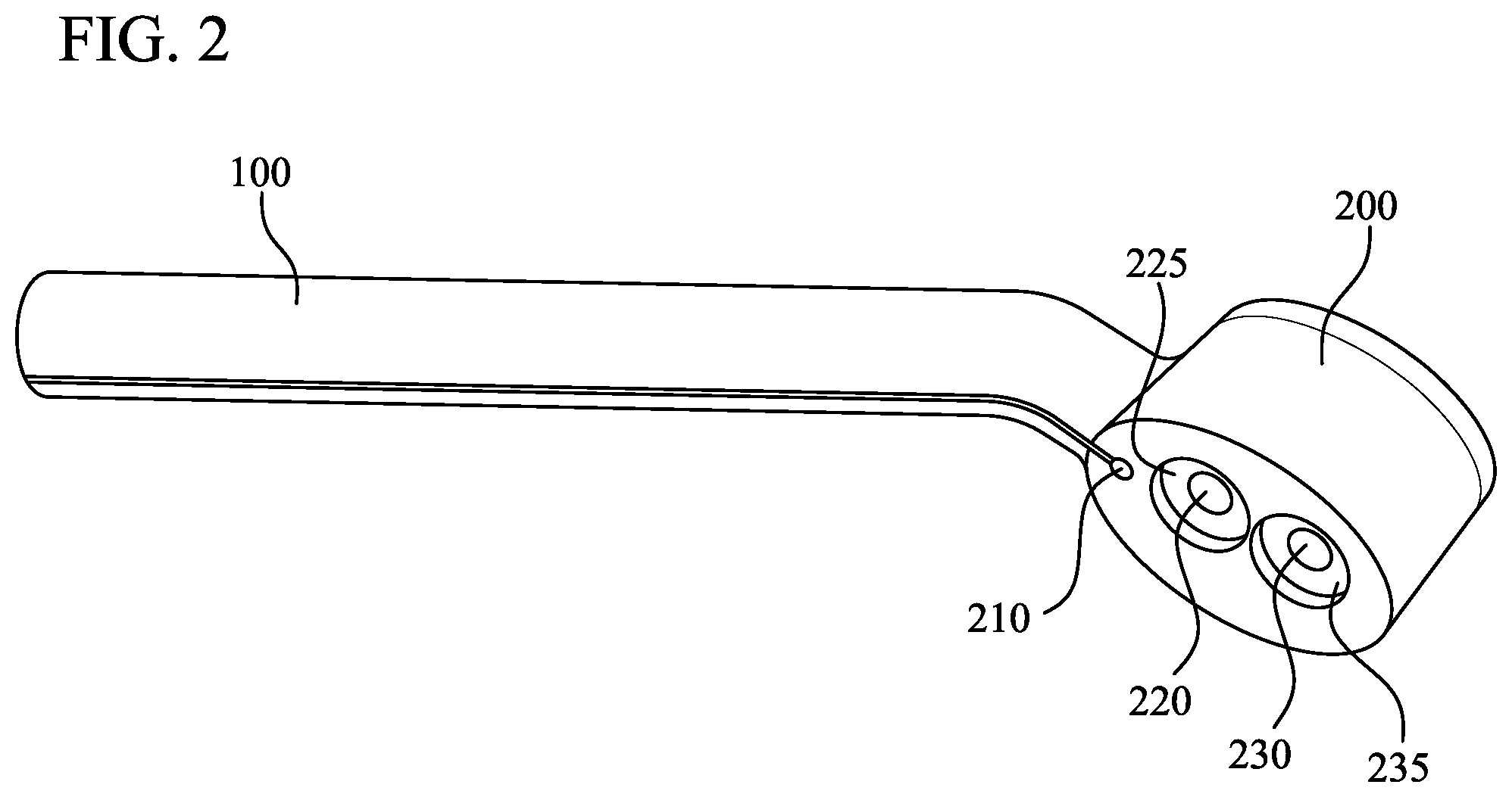 Patent US11793528 Figure 2 – Supracondylar fracture mending device