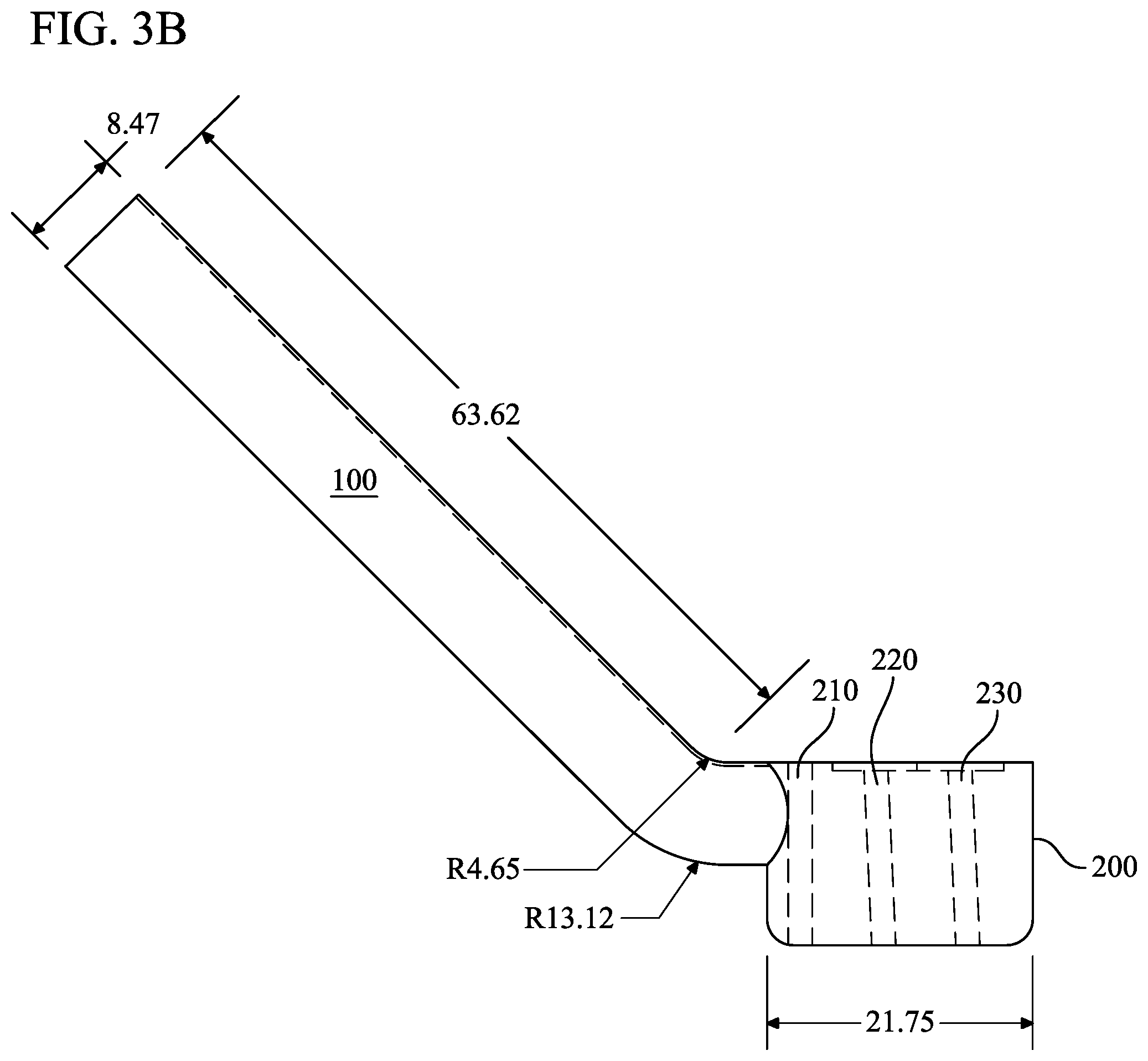 Patent US11793528 Figure 4 – Supracondylar fracture mending device