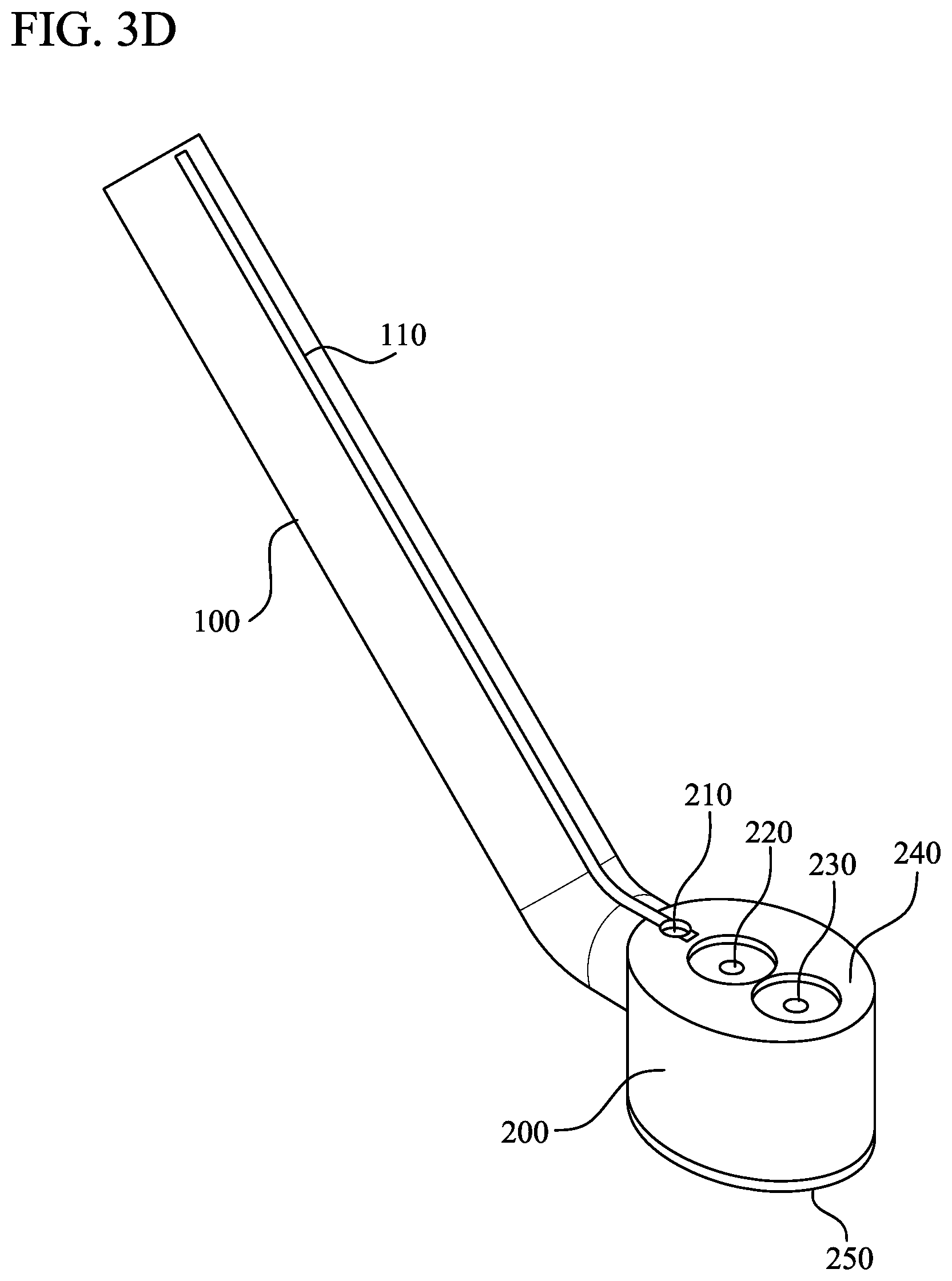 Patent US11793528 Figure 6 – Supracondylar fracture mending device