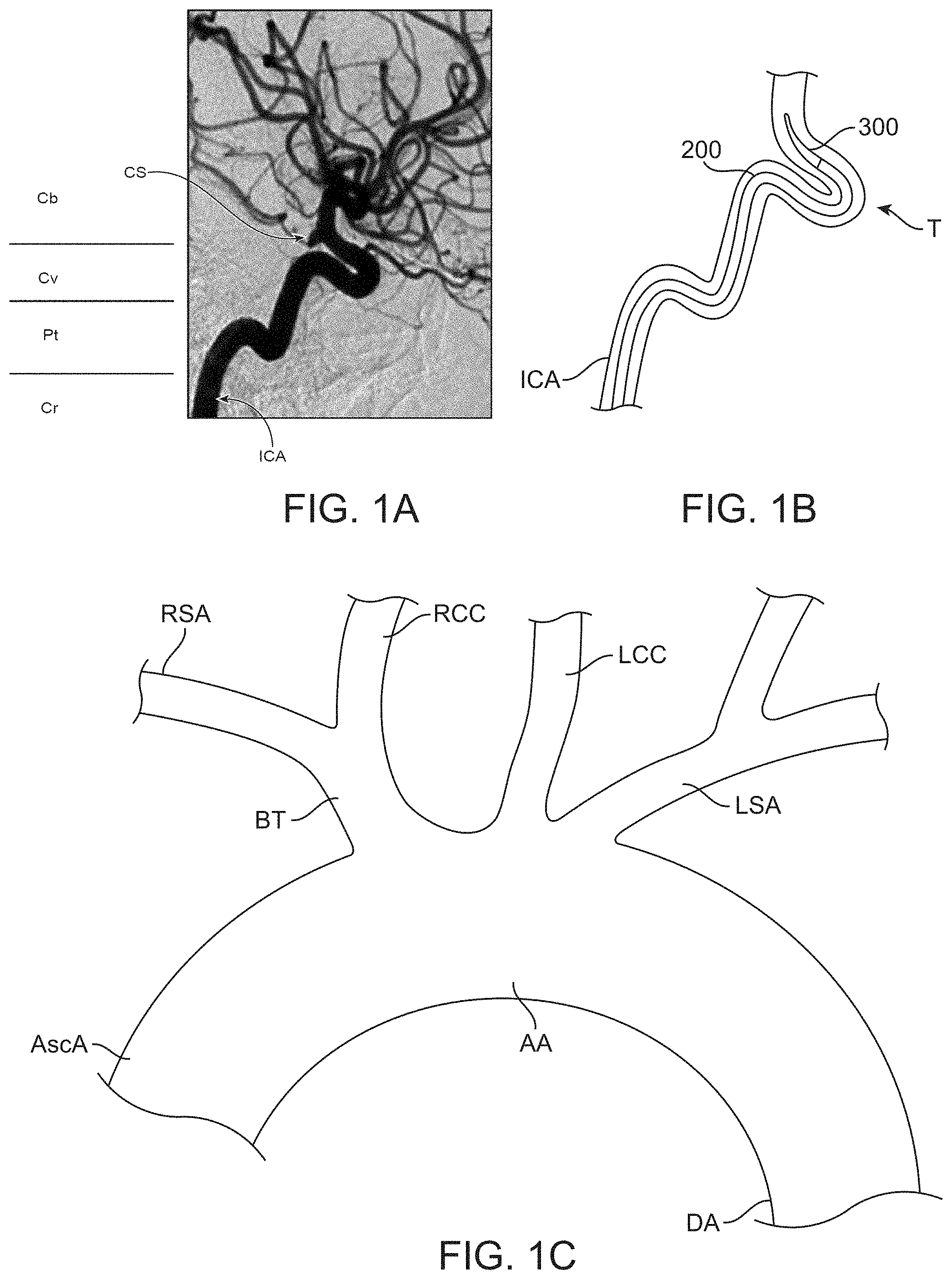 Patent US11793529 Figure 1 – Aspiration catheter systems and methods of use