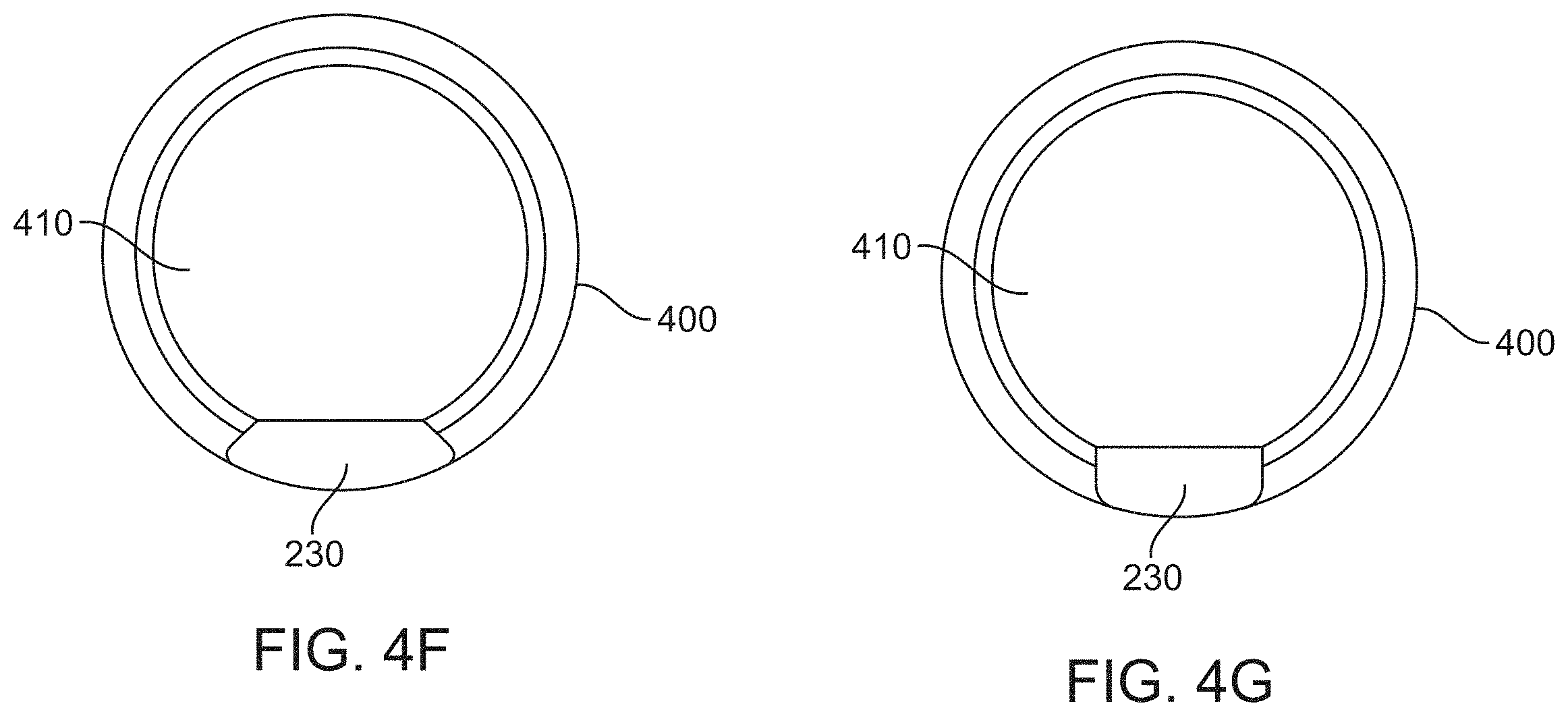 Patent US11793529 Figure 5 – Aspiration catheter systems and methods of use