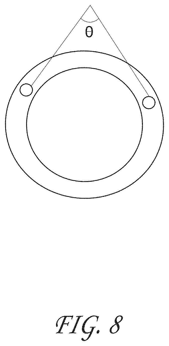 Patent US11793531 Figure 8 – Axial lengthening thrombus capture system, tensioning system and expandable funnel catheter