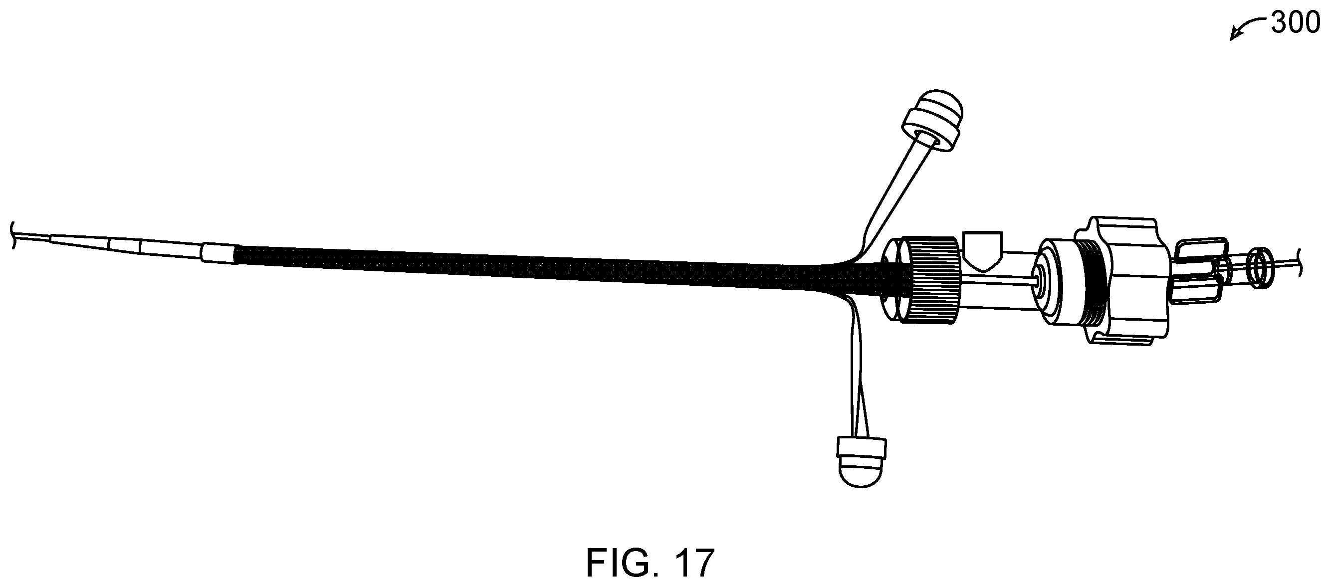 Patent US11793531 Figure 17 – Axial lengthening thrombus capture system, tensioning system and expandable funnel catheter