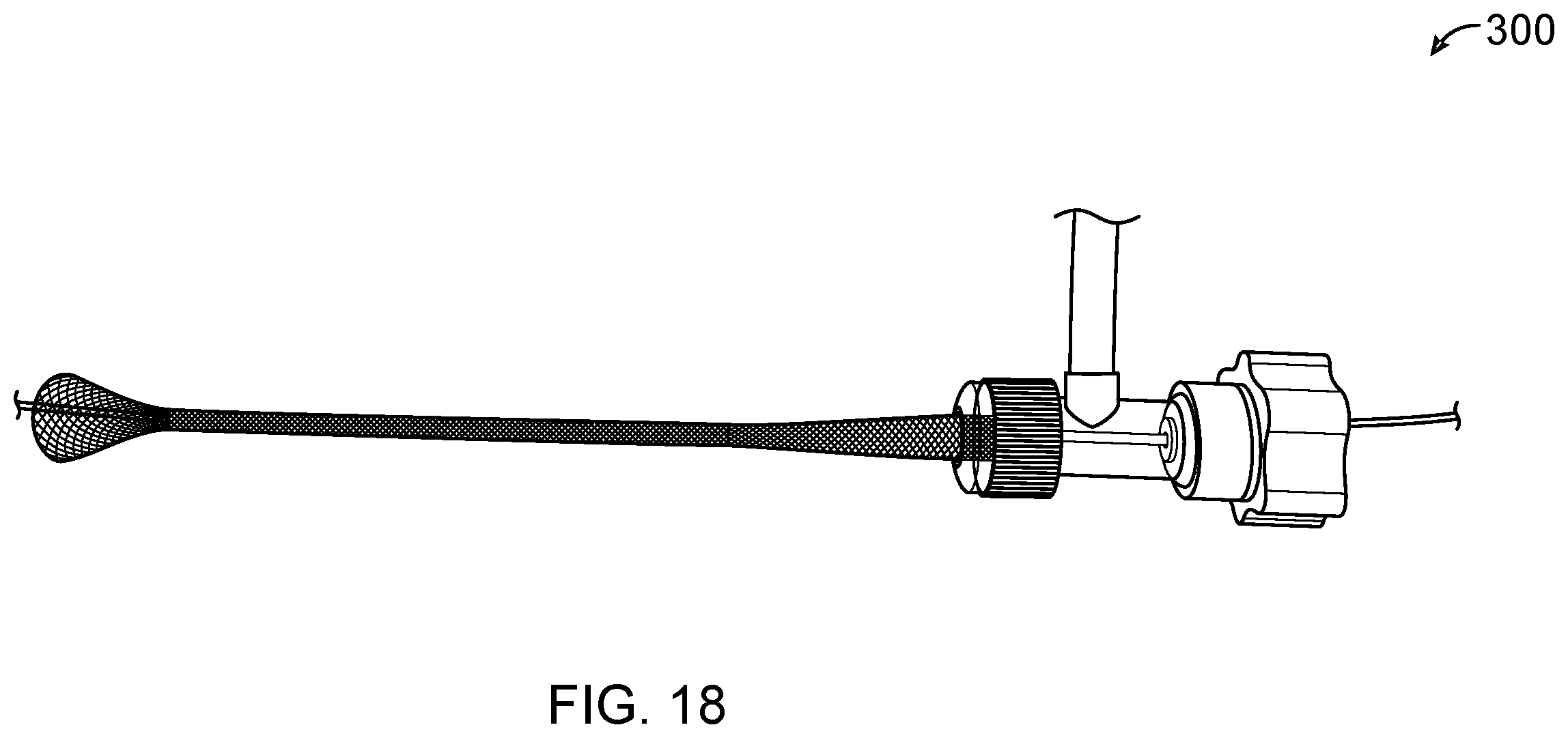 Patent US11793531 Figure 18 – Axial lengthening thrombus capture system, tensioning system and expandable funnel catheter