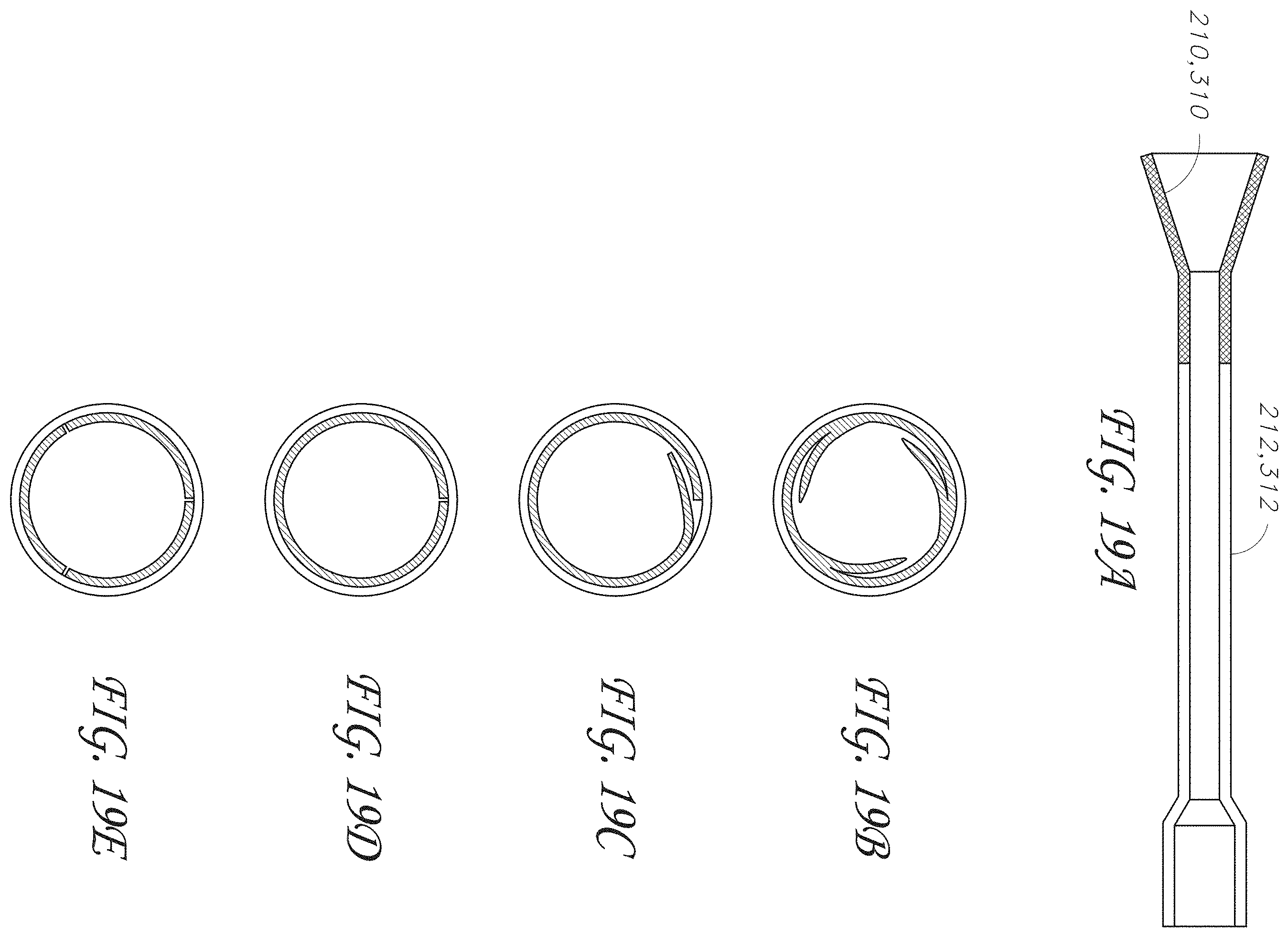 Patent US11793531 Figure 19 – Axial lengthening thrombus capture system, tensioning system and expandable funnel catheter