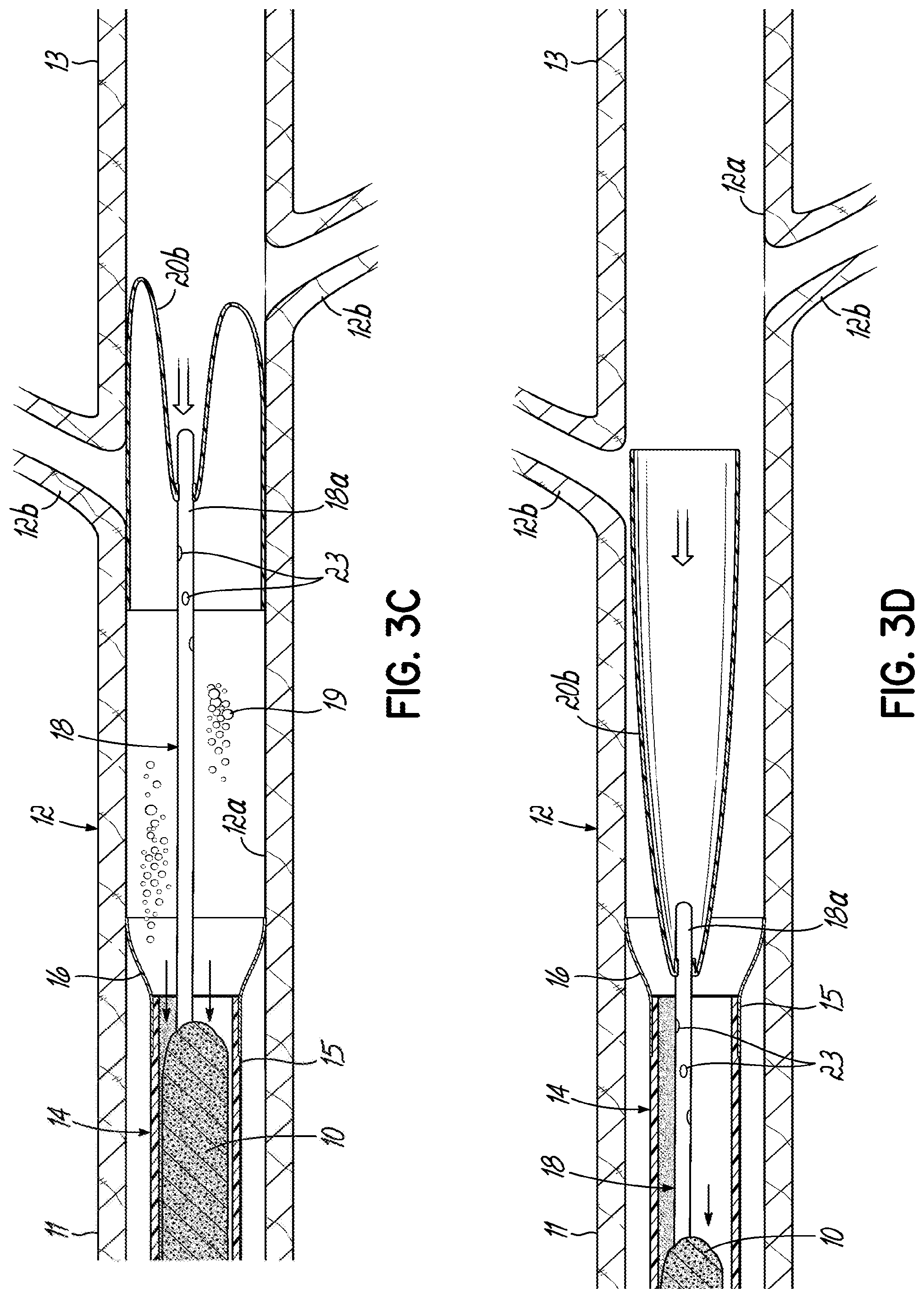 Patent US11793532 Figure 7 – Devices, systems and methods to remove blood clots