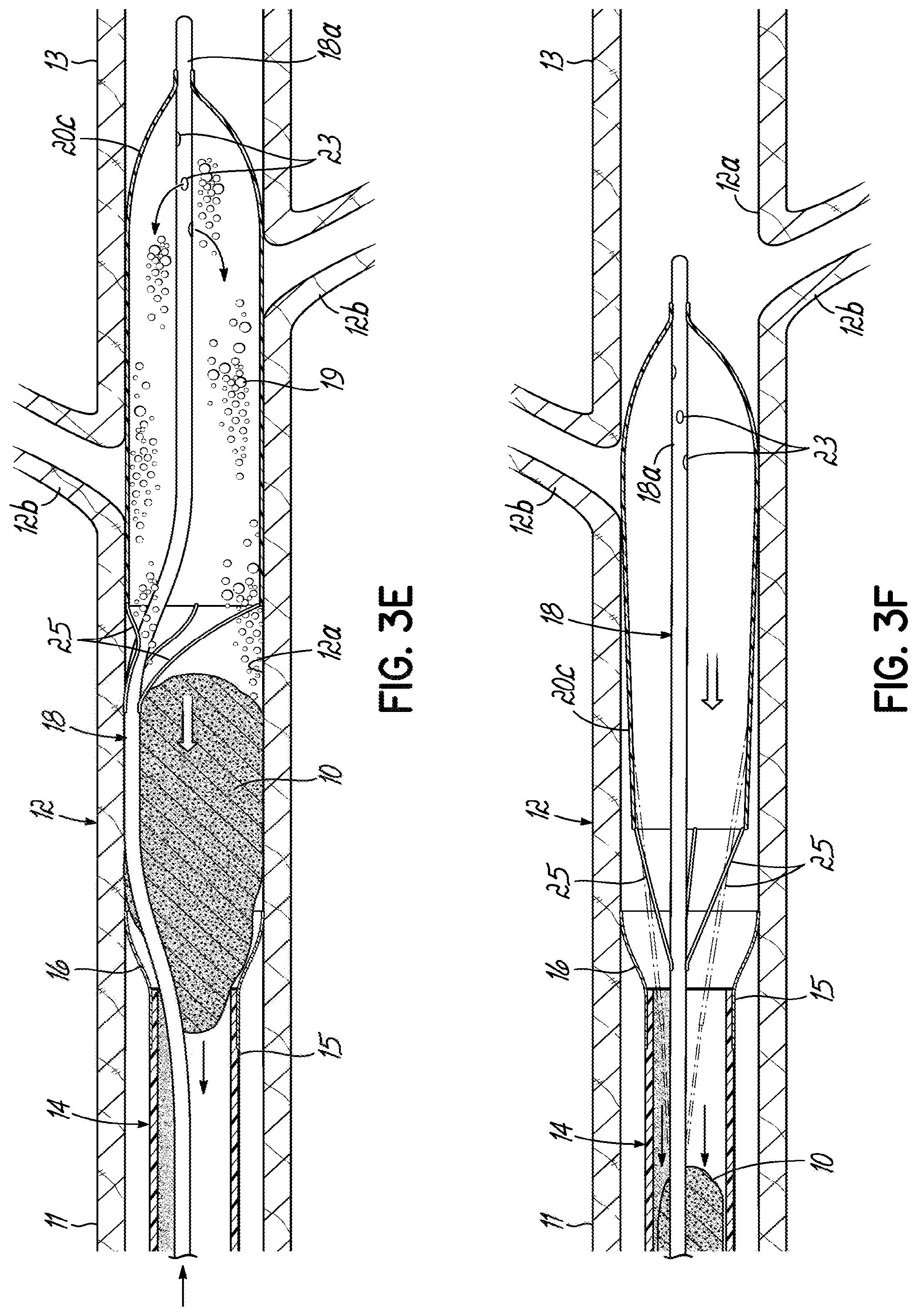 Patent US11793532 Figure 8 – Devices, systems and methods to remove blood clots
