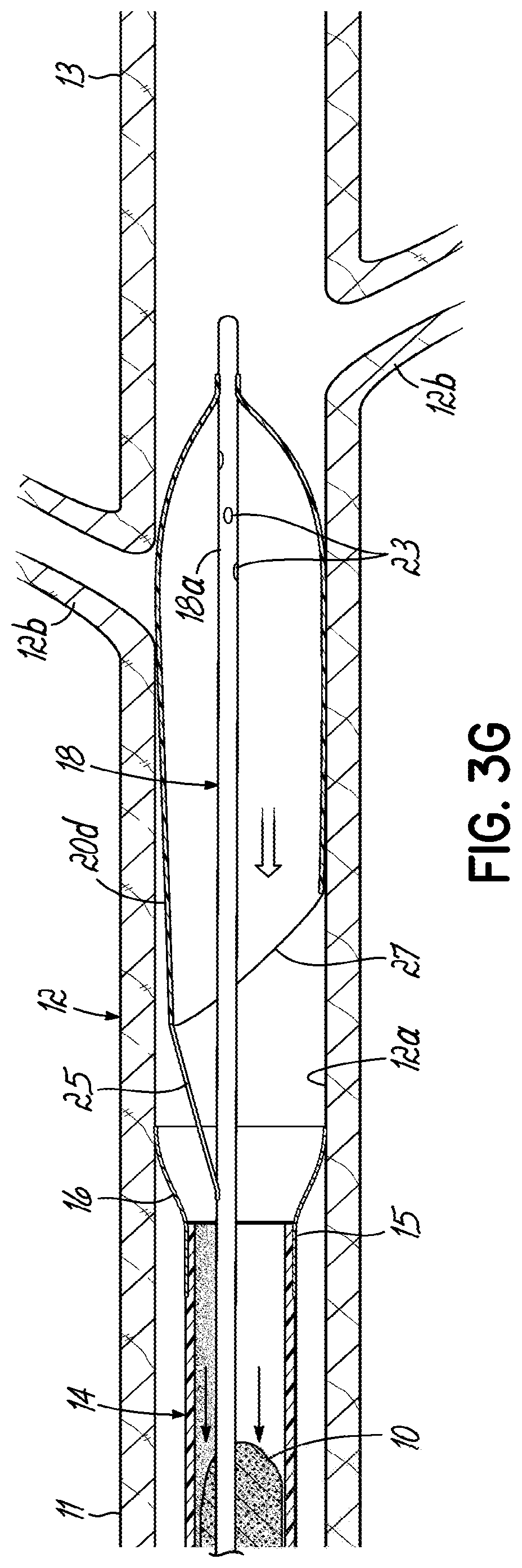 Patent US11793532 Figure 9 – Devices, systems and methods to remove blood clots