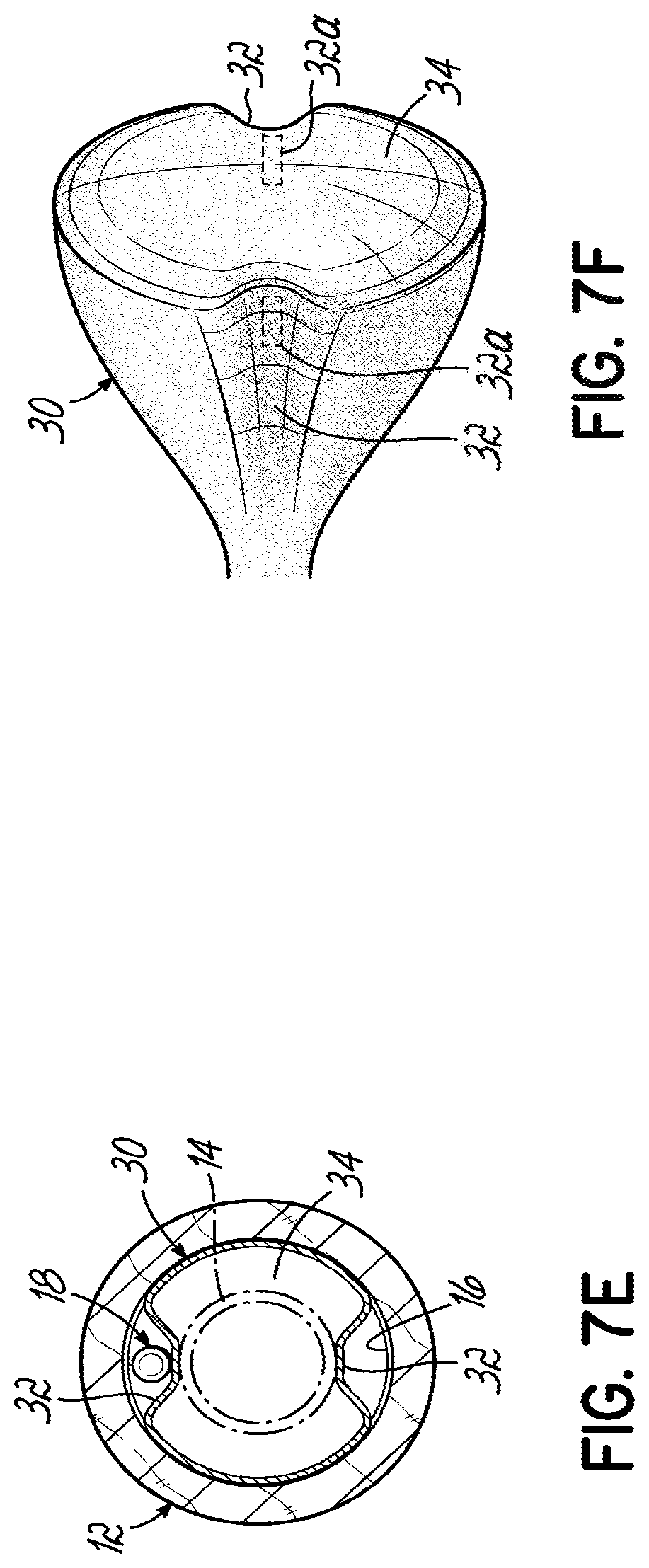 Patent US11793532 Figure 17 – Devices, systems and methods to remove blood clots
