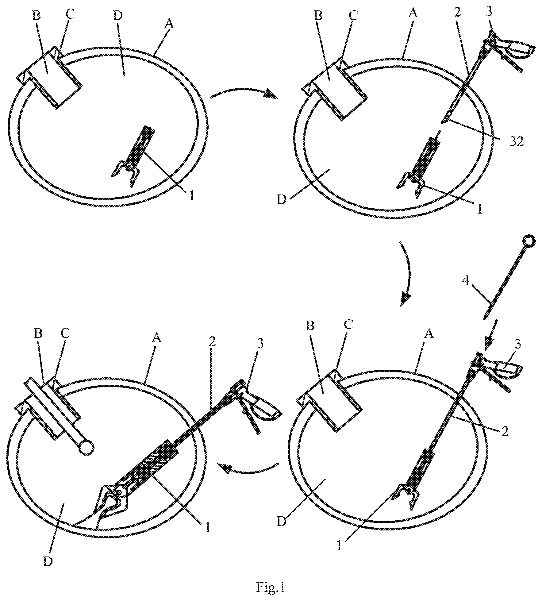 Patent US11793535 Figure 1 – Endoluminal surgery device