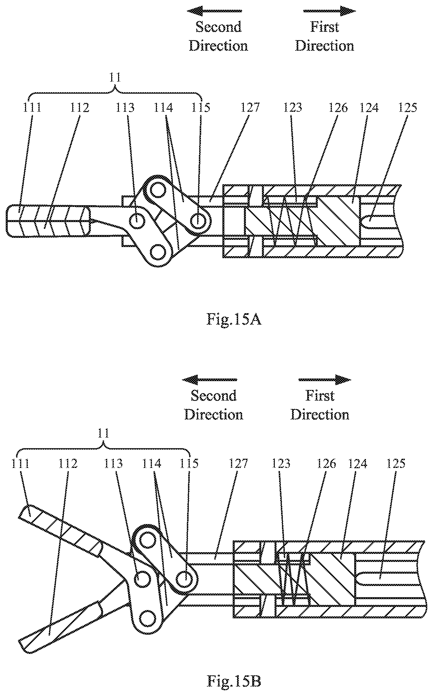Patent US11793535 Figure 11 – Endoluminal surgery device