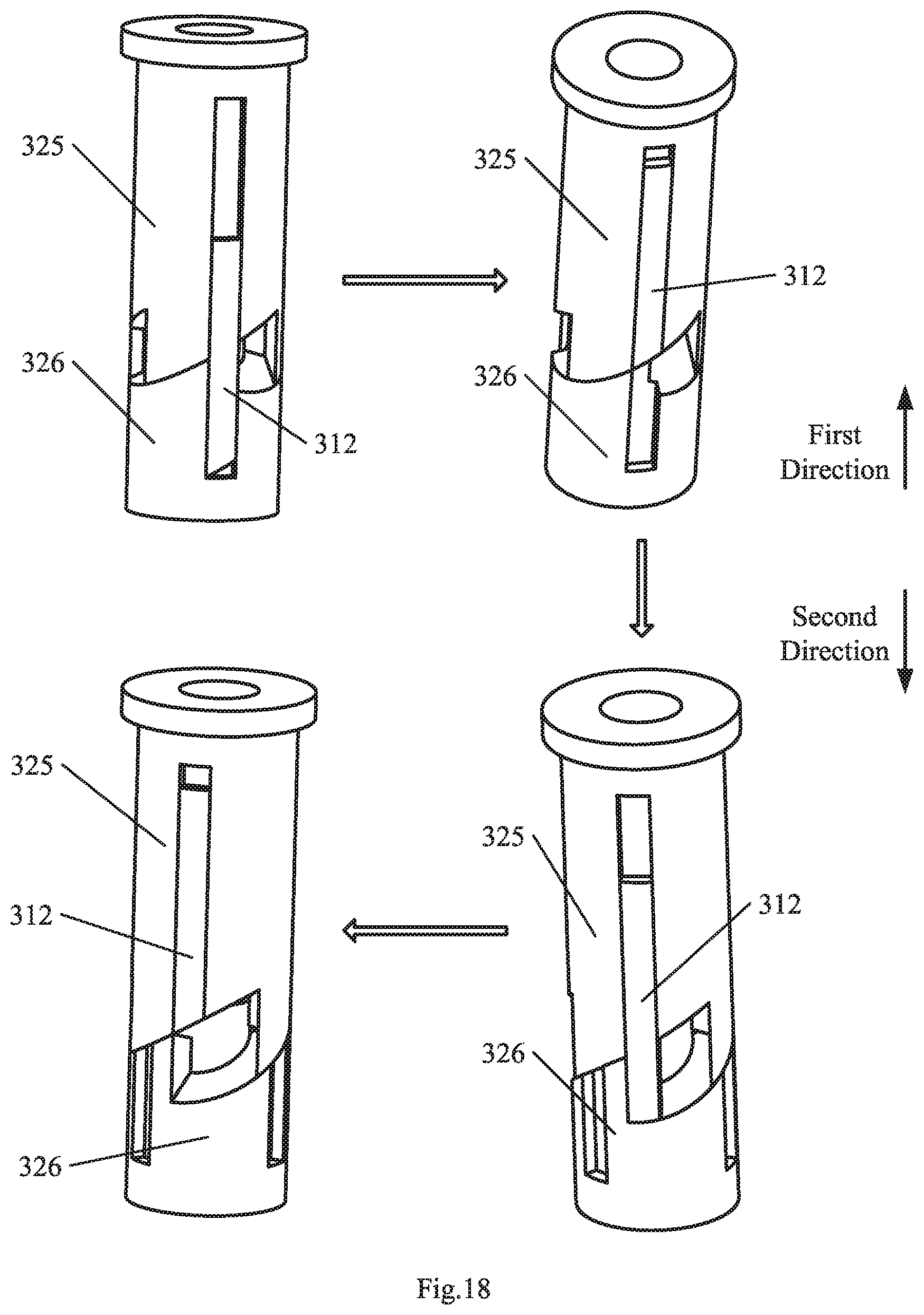 Patent US11793535 Figure 14 – Endoluminal surgery device
