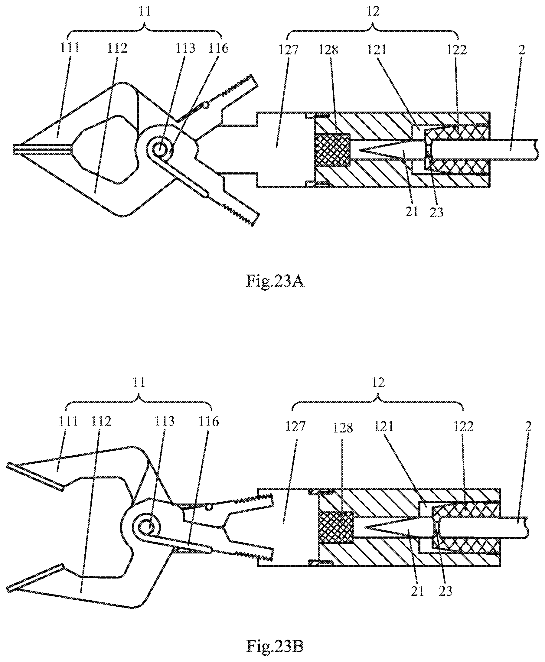 Patent US11793535 Figure 17 – Endoluminal surgery device