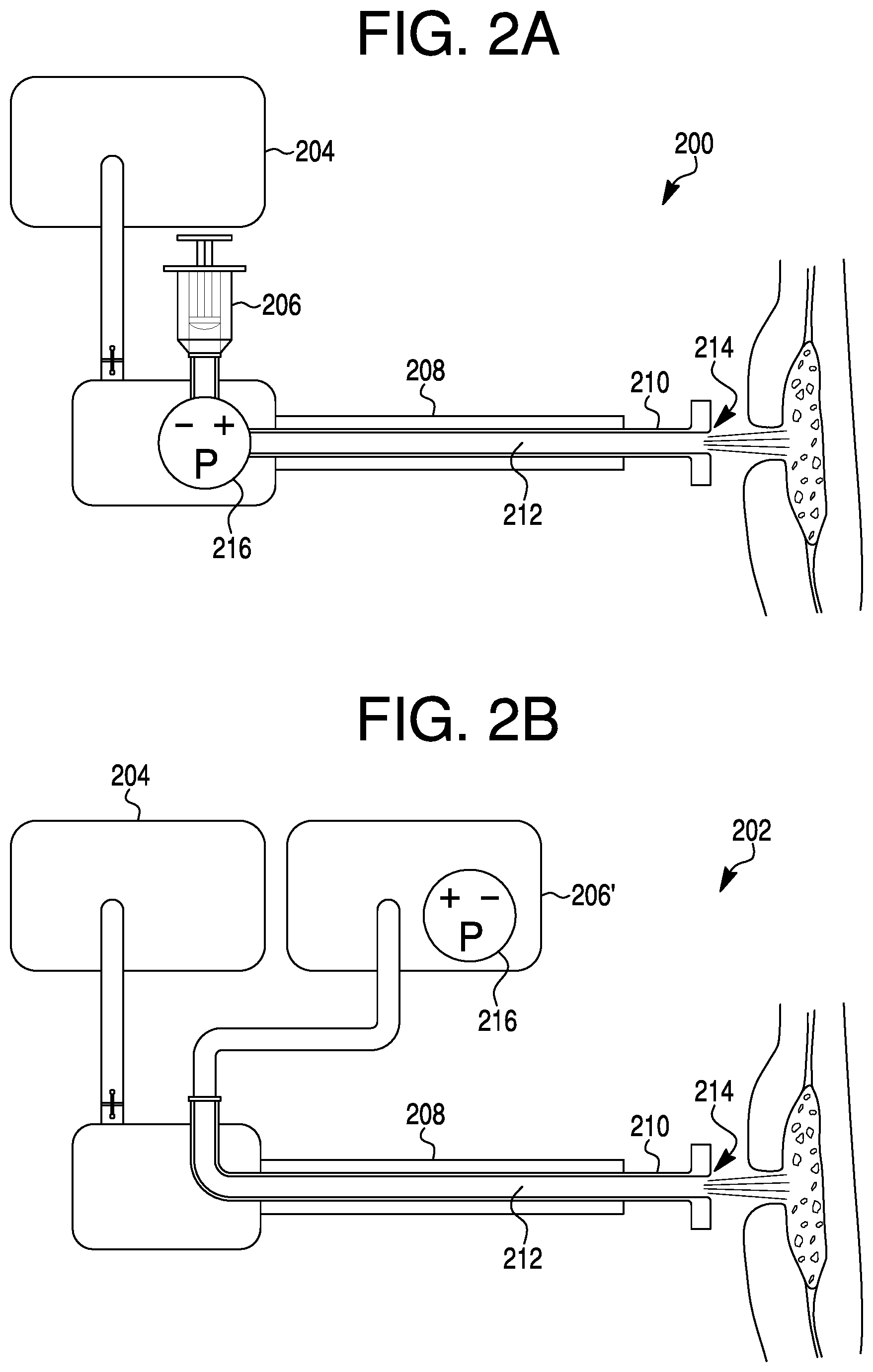 Patent US11793540 Figure 2 – Medical device with a flow controller