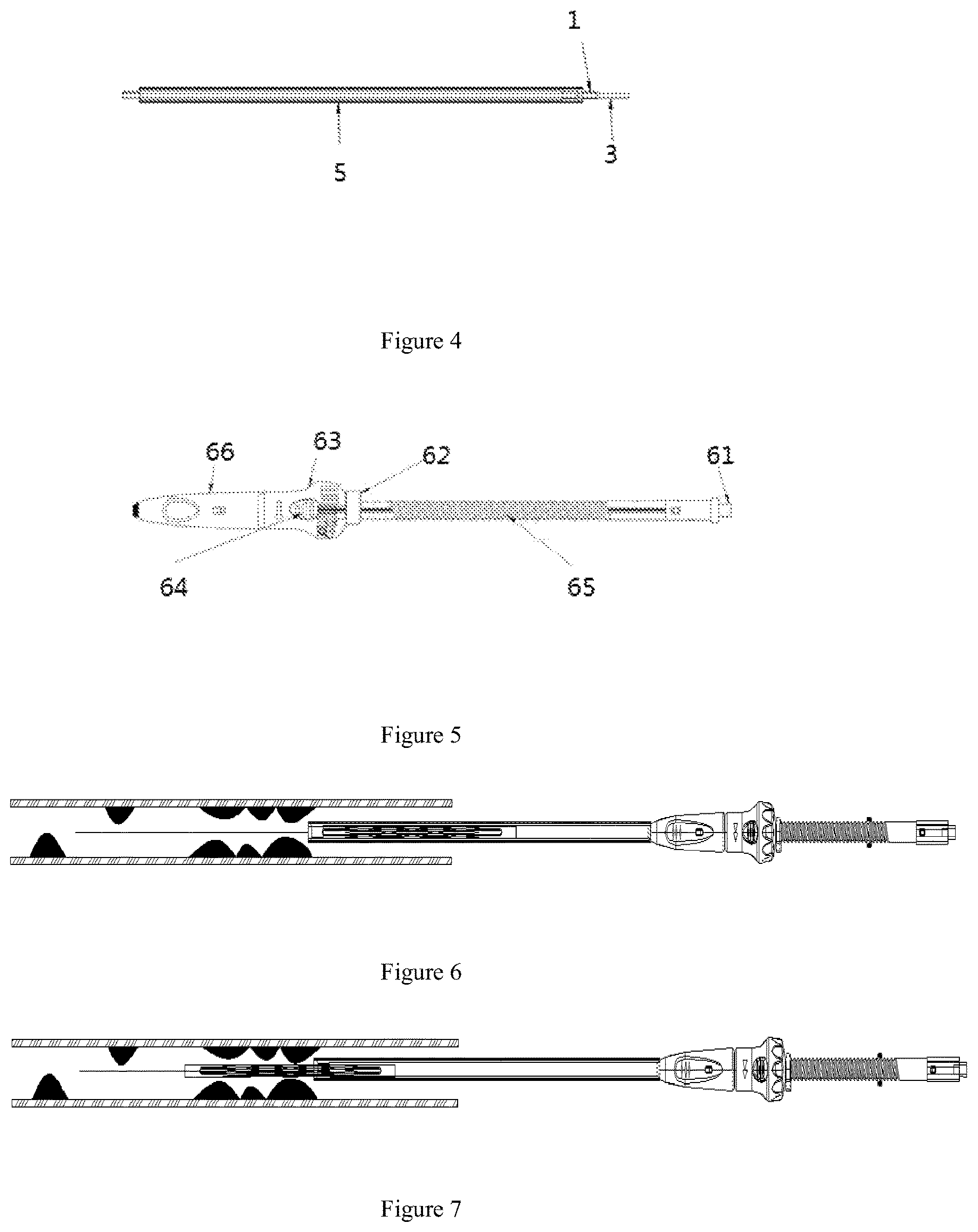 Patent US11793541 Figure 2 – Plaque removal device