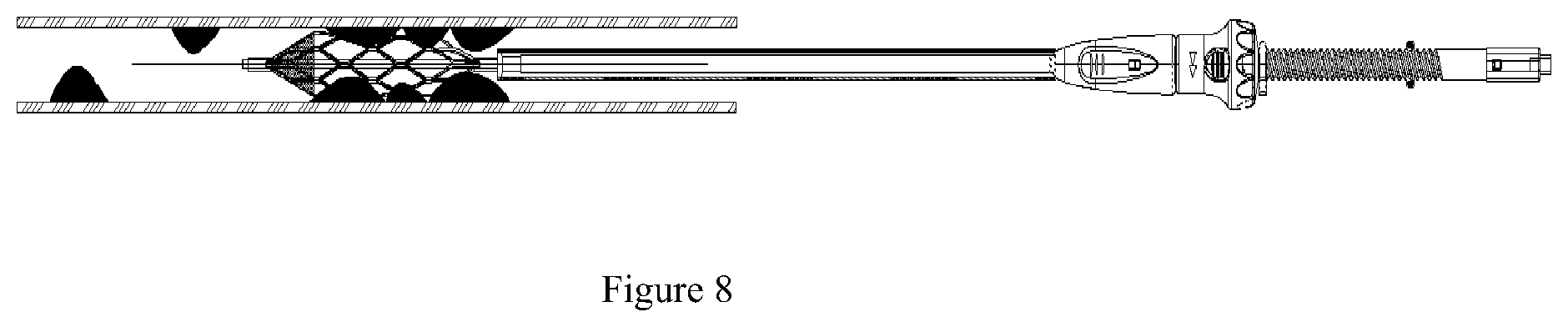 Patent US11793541 Figure 3 – Plaque removal device