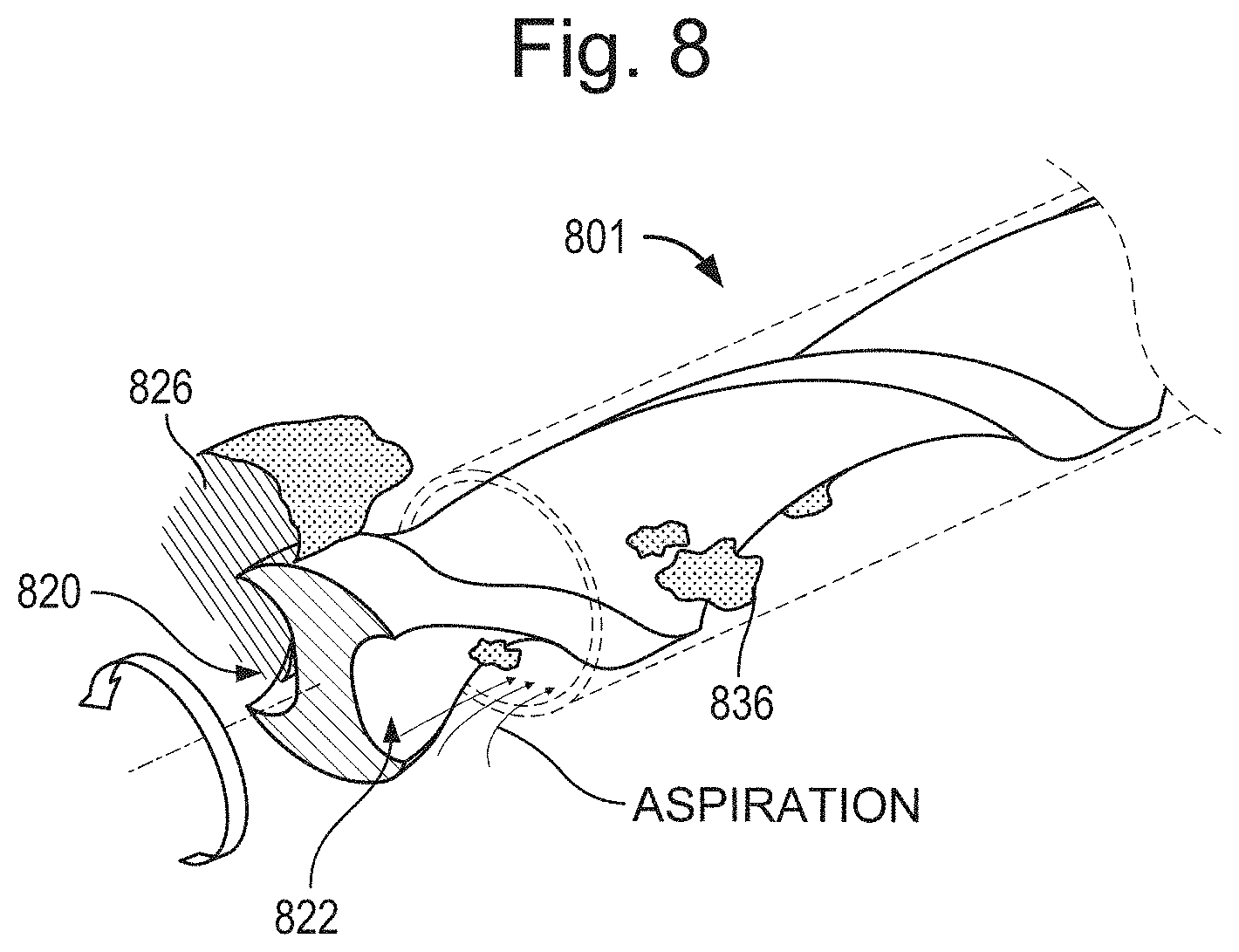 Patent US11793542 Figure 10 – Helical separator and methods of operating the same