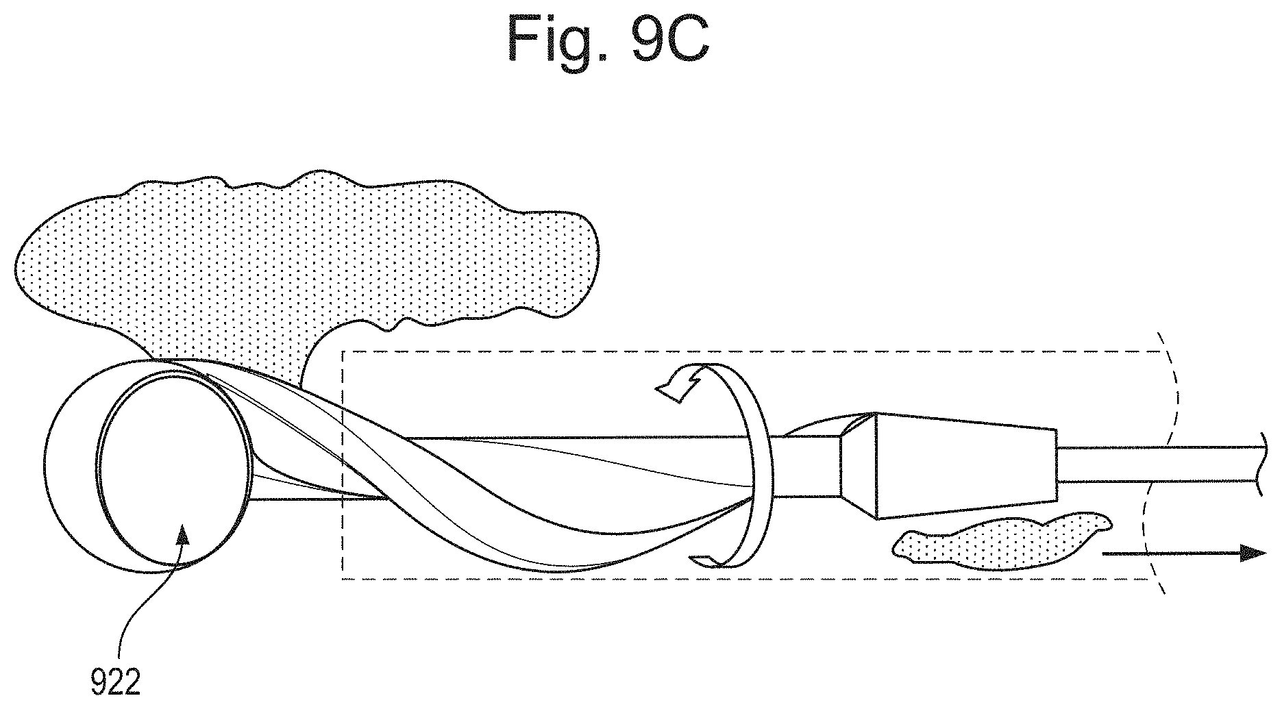 Patent US11793542 Figure 12 – Helical separator and methods of operating the same