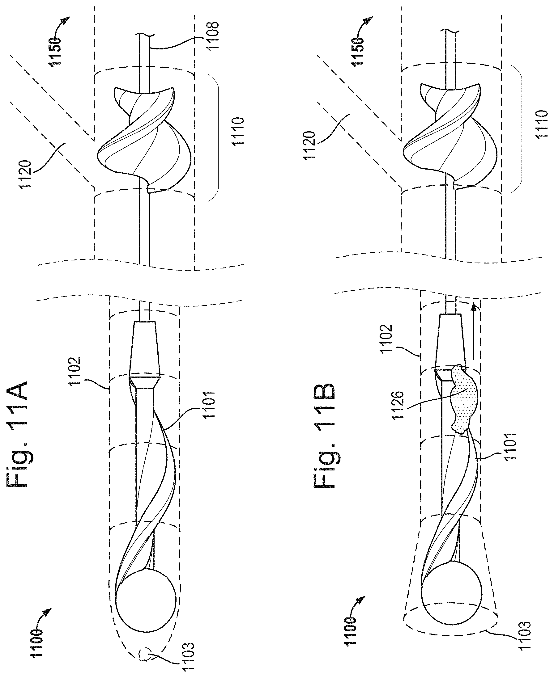 Patent US11793542 Figure 14 – Helical separator and methods of operating the same