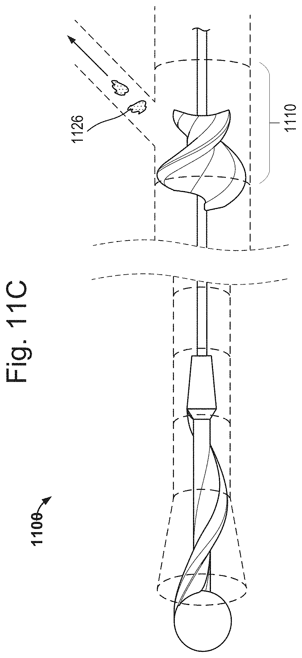 Patent US11793542 Figure 15 – Helical separator and methods of operating the same