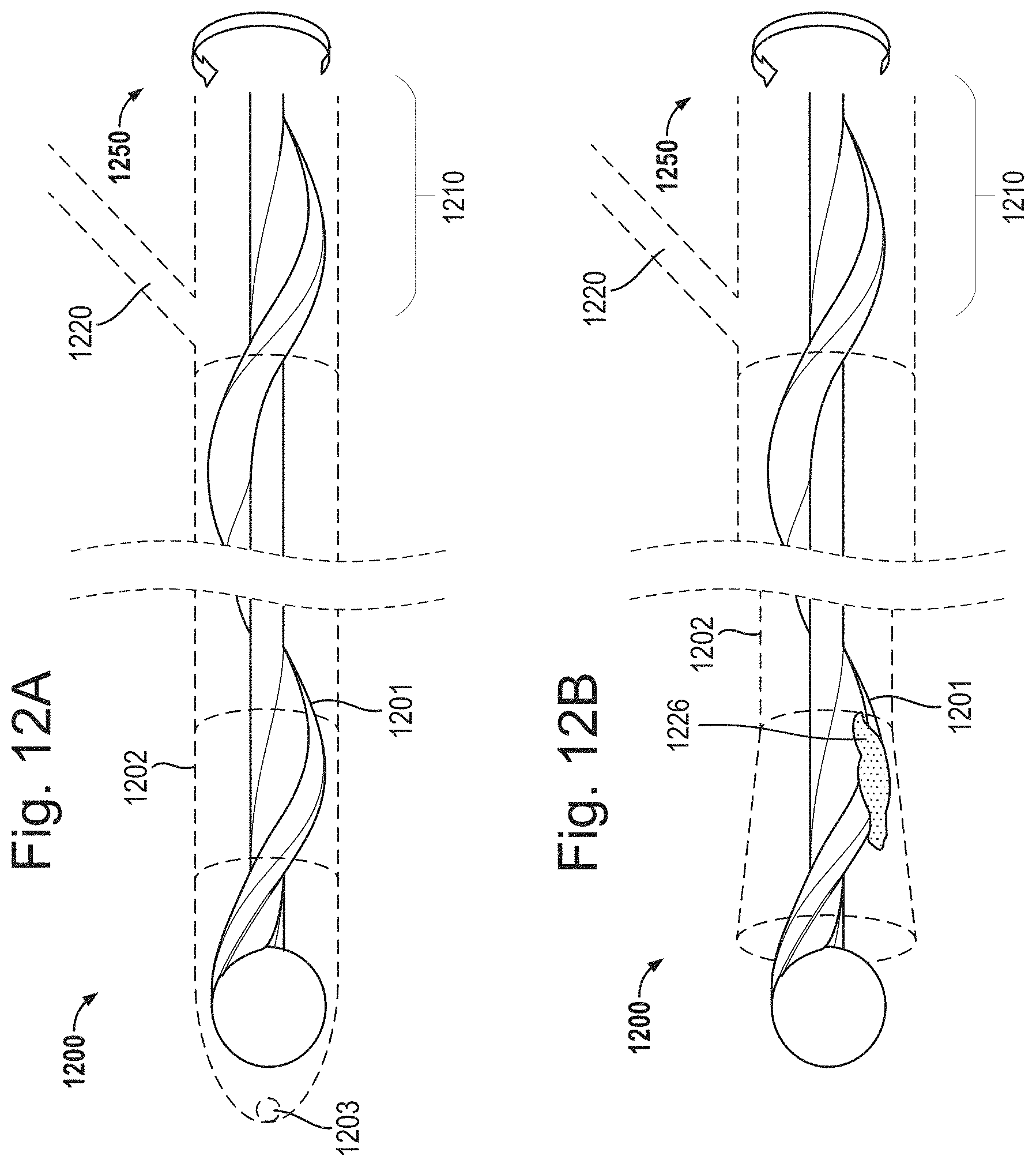 Patent US11793542 Figure 16 – Helical separator and methods of operating the same