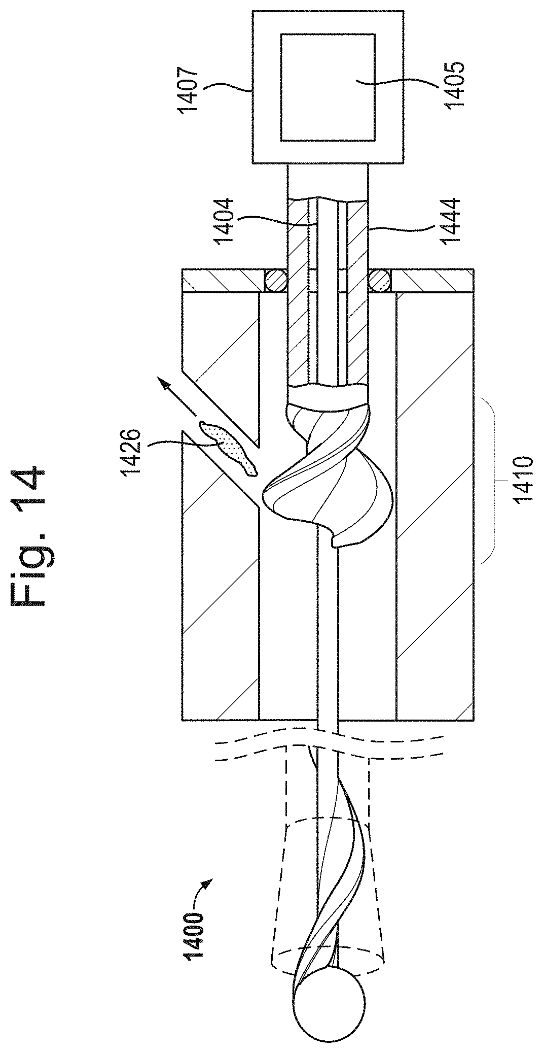 Patent US11793542 Figure 19 – Helical separator and methods of operating the same