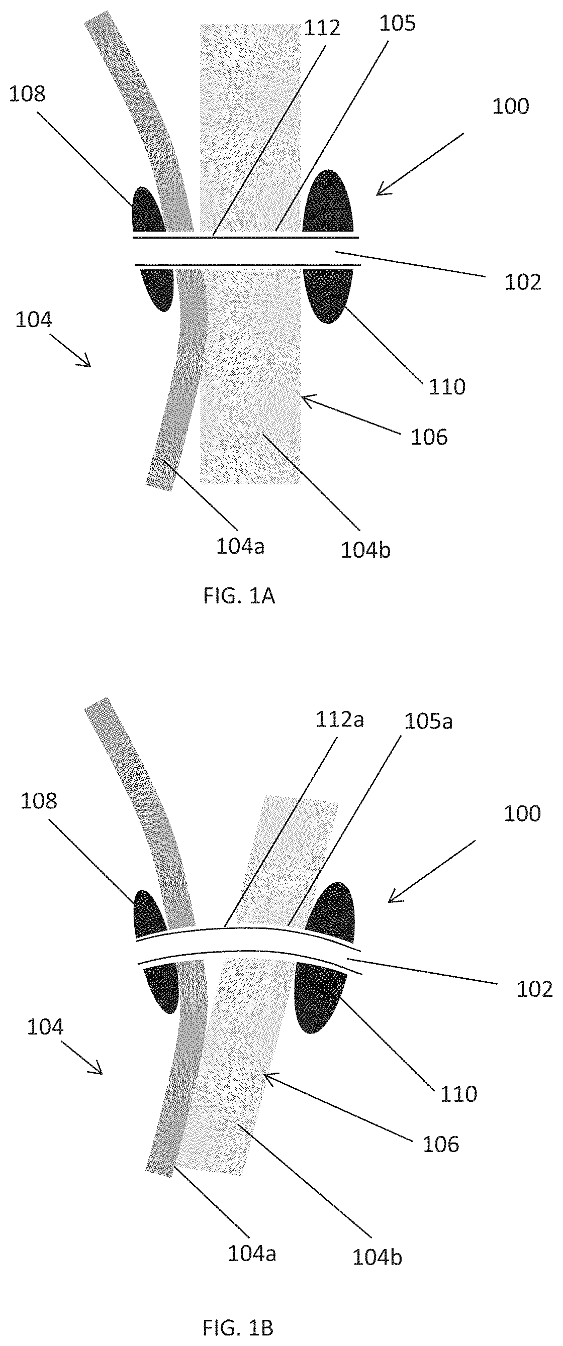 Patent US11793544 Figure 1 – Measuring device