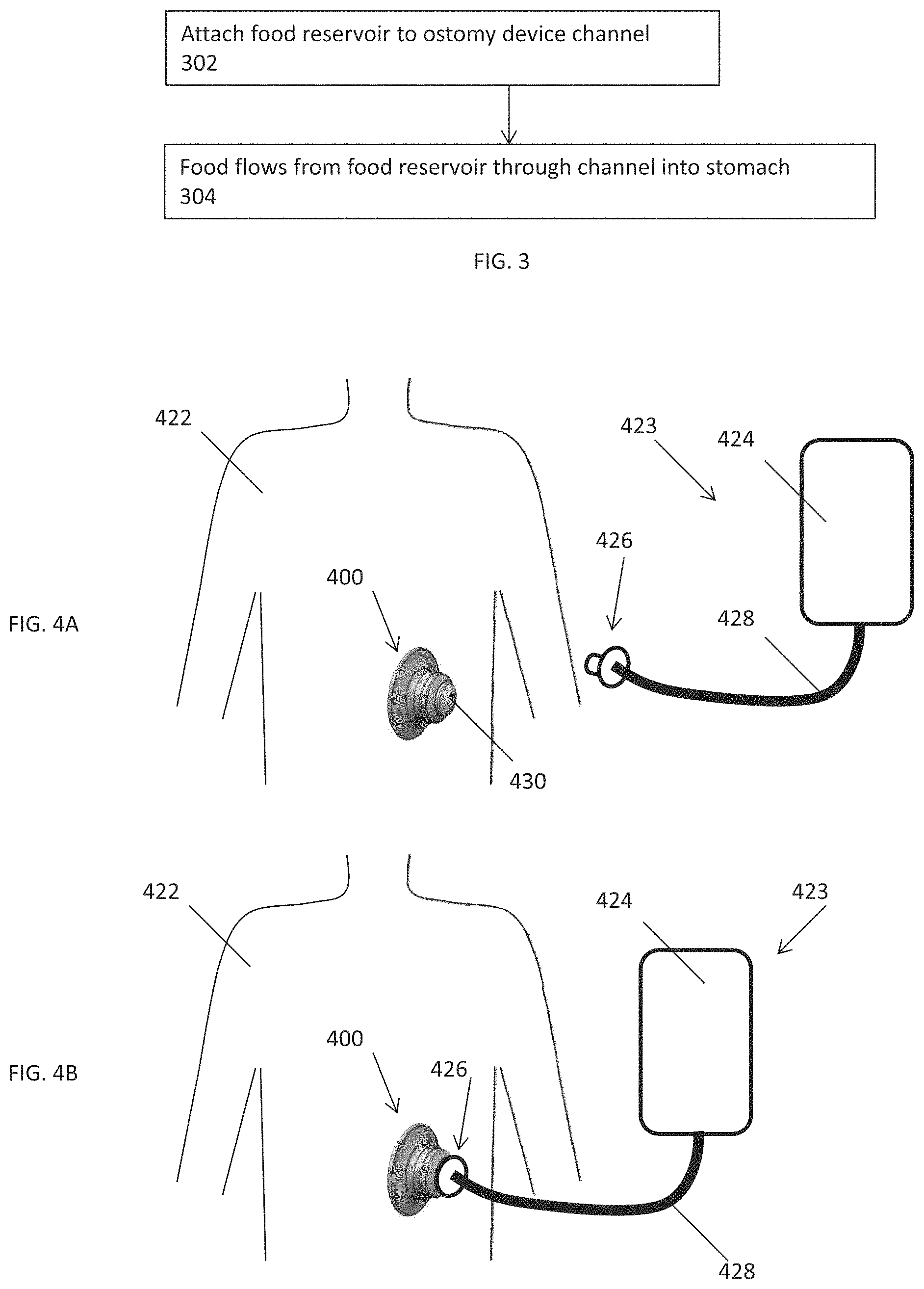 Patent US11793544 Figure 3 – Measuring device