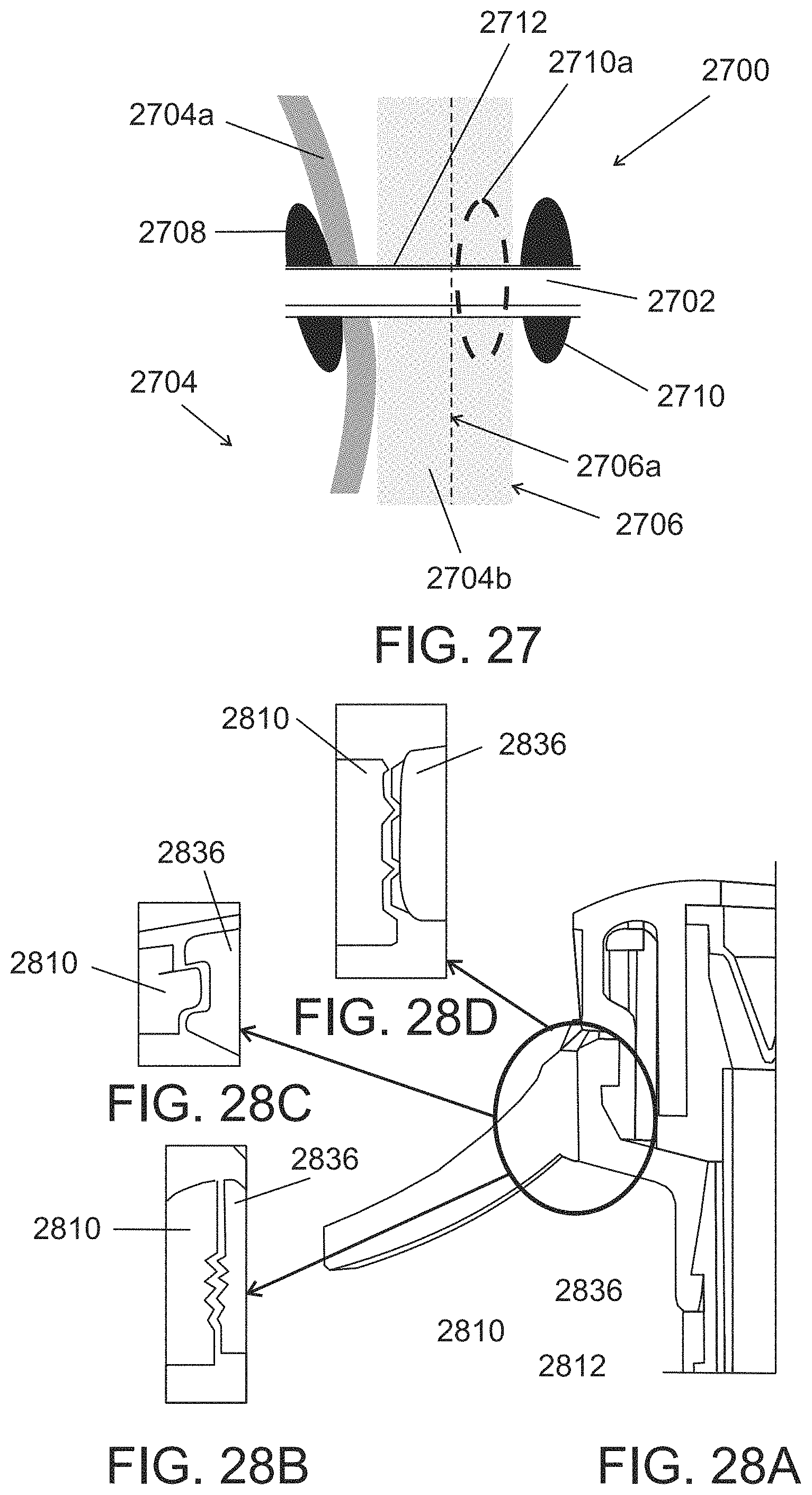 Patent US11793544 Figure 13 – Measuring device