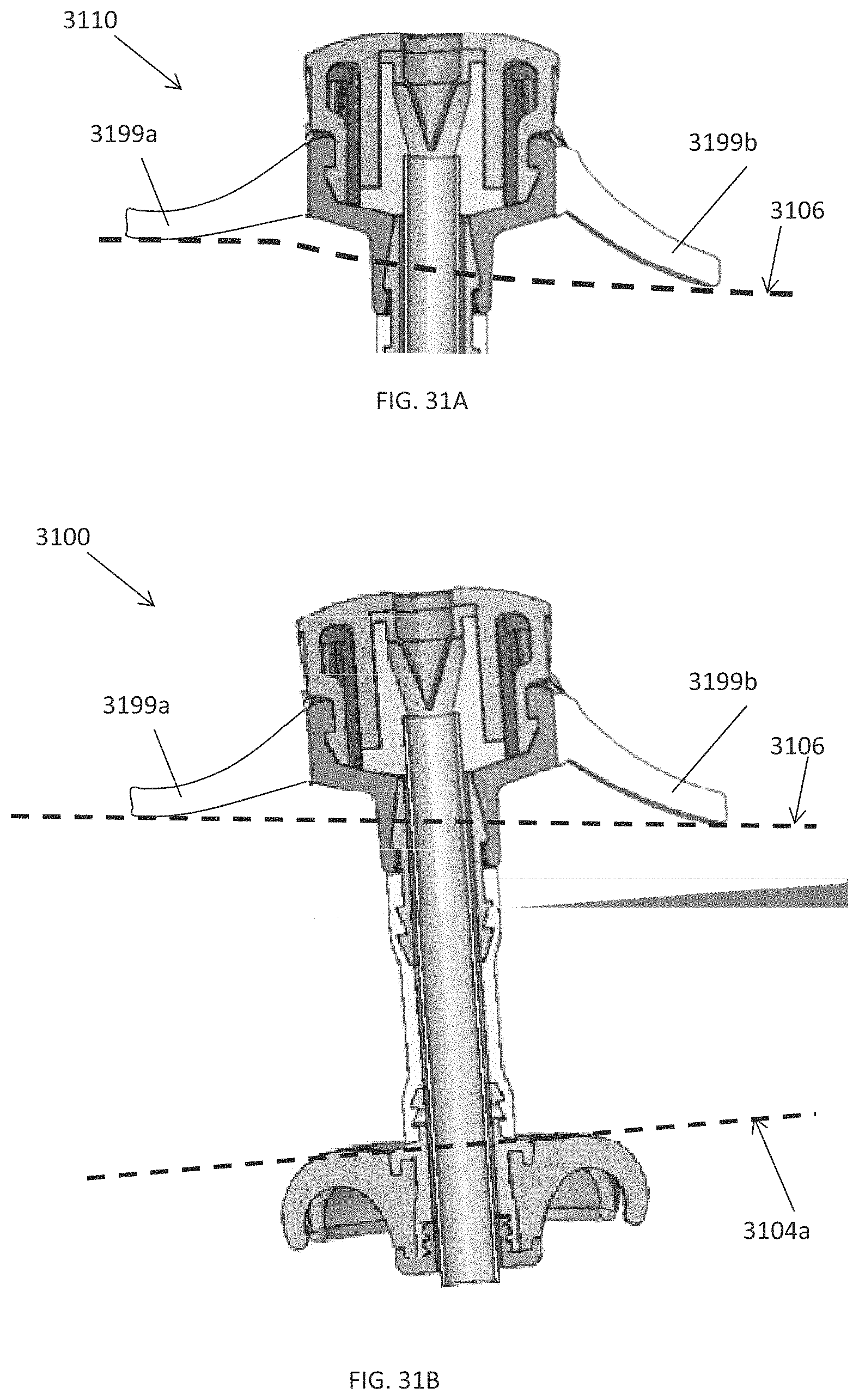 Patent US11793544 Figure 15 – Measuring device