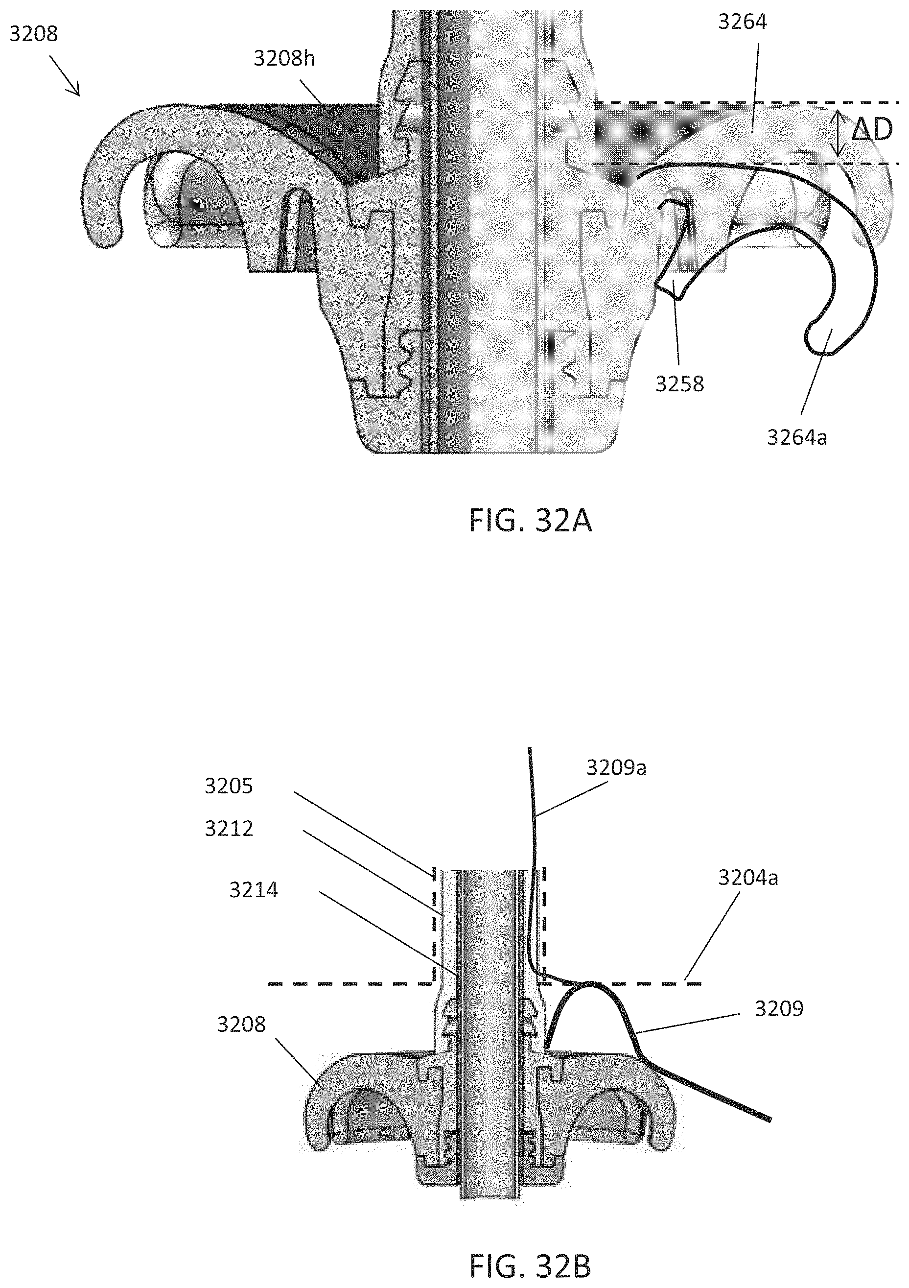 Patent US11793544 Figure 16 – Measuring device