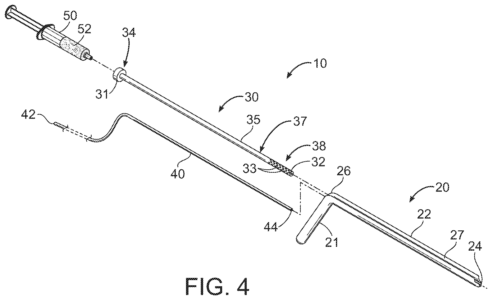 Patent US11793545 Figure 3 – Adductor canal block introducer
