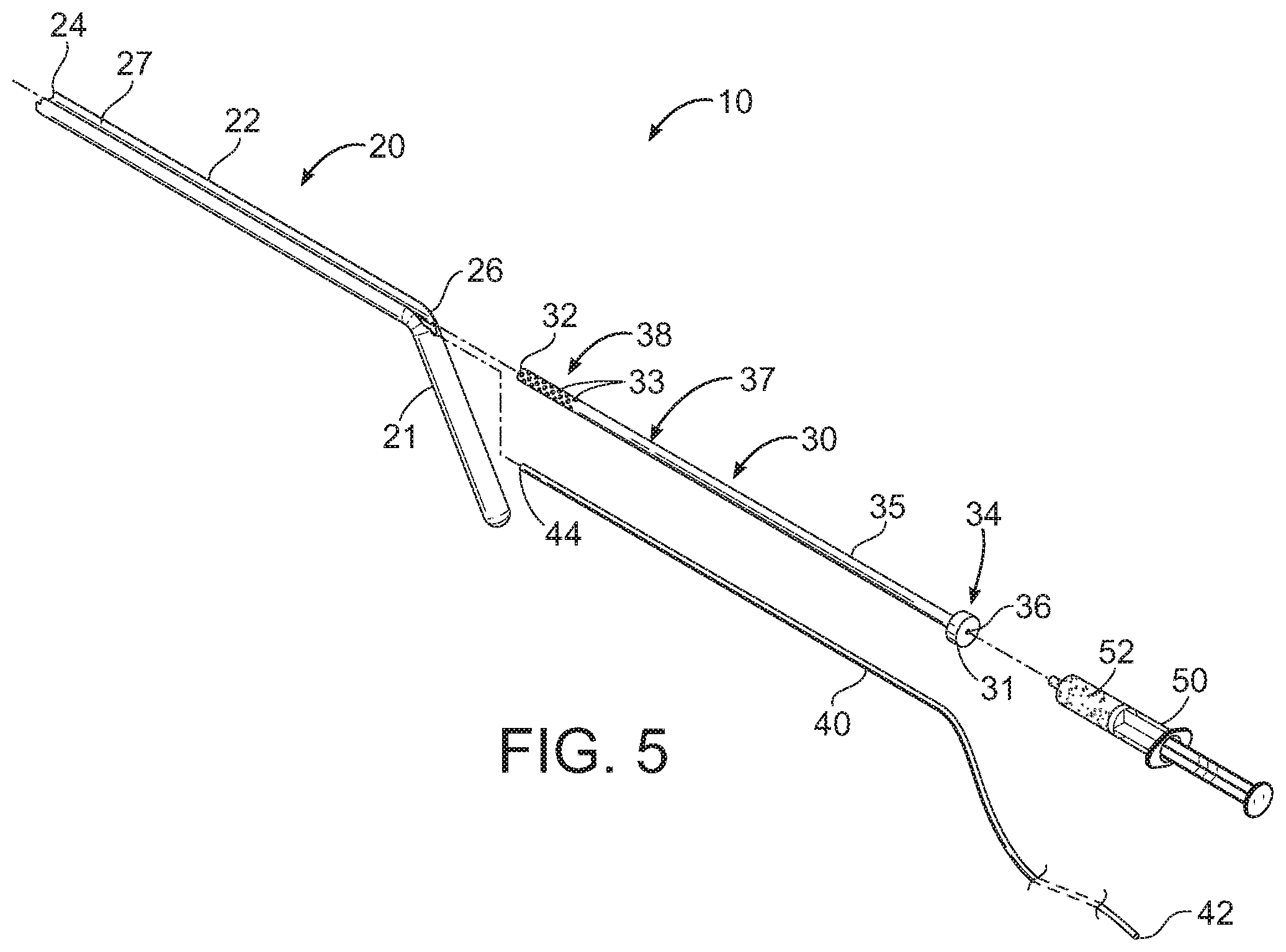 Patent US11793545 Figure 4 – Adductor canal block introducer