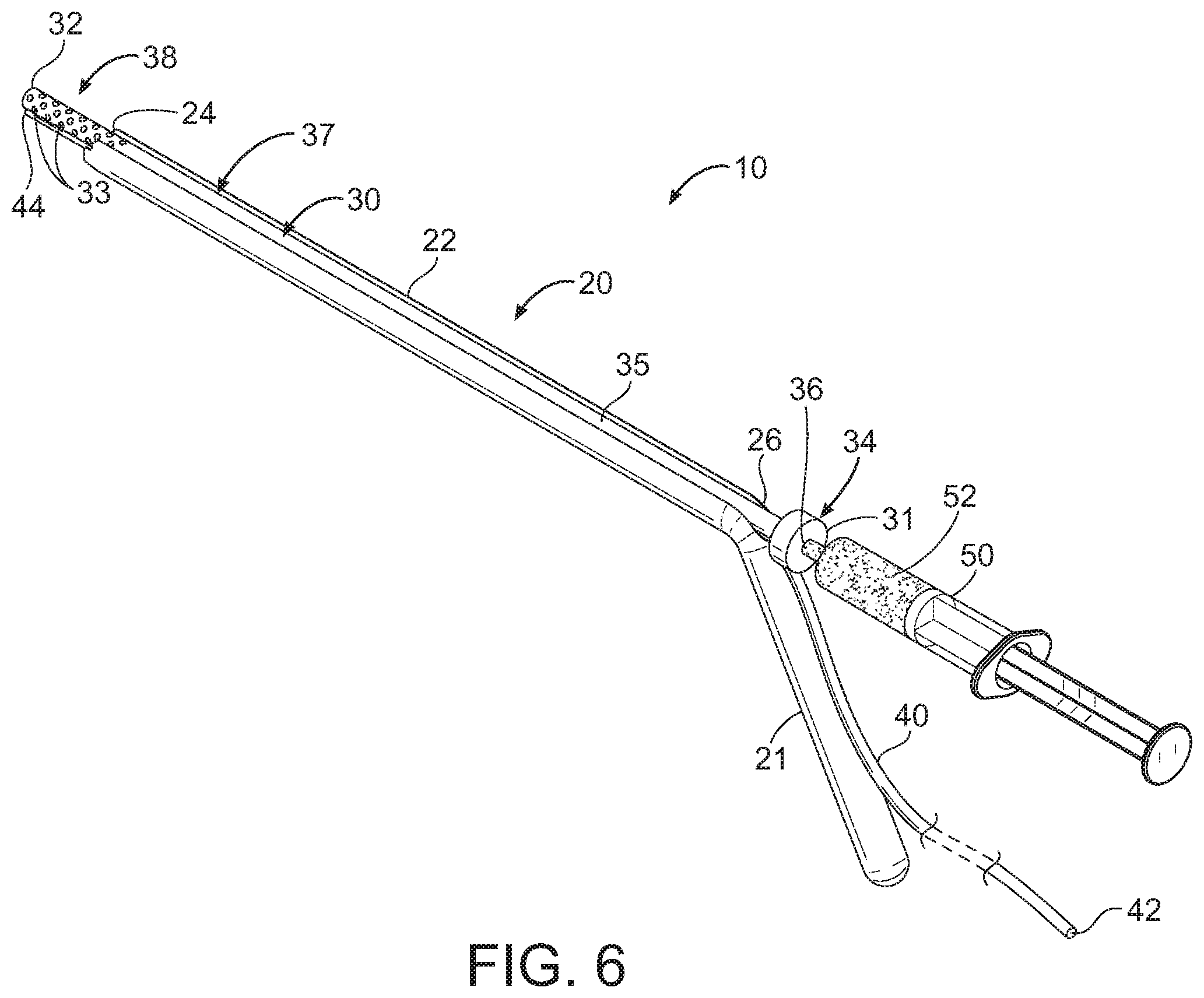 Patent US11793545 Figure 5 – Adductor canal block introducer