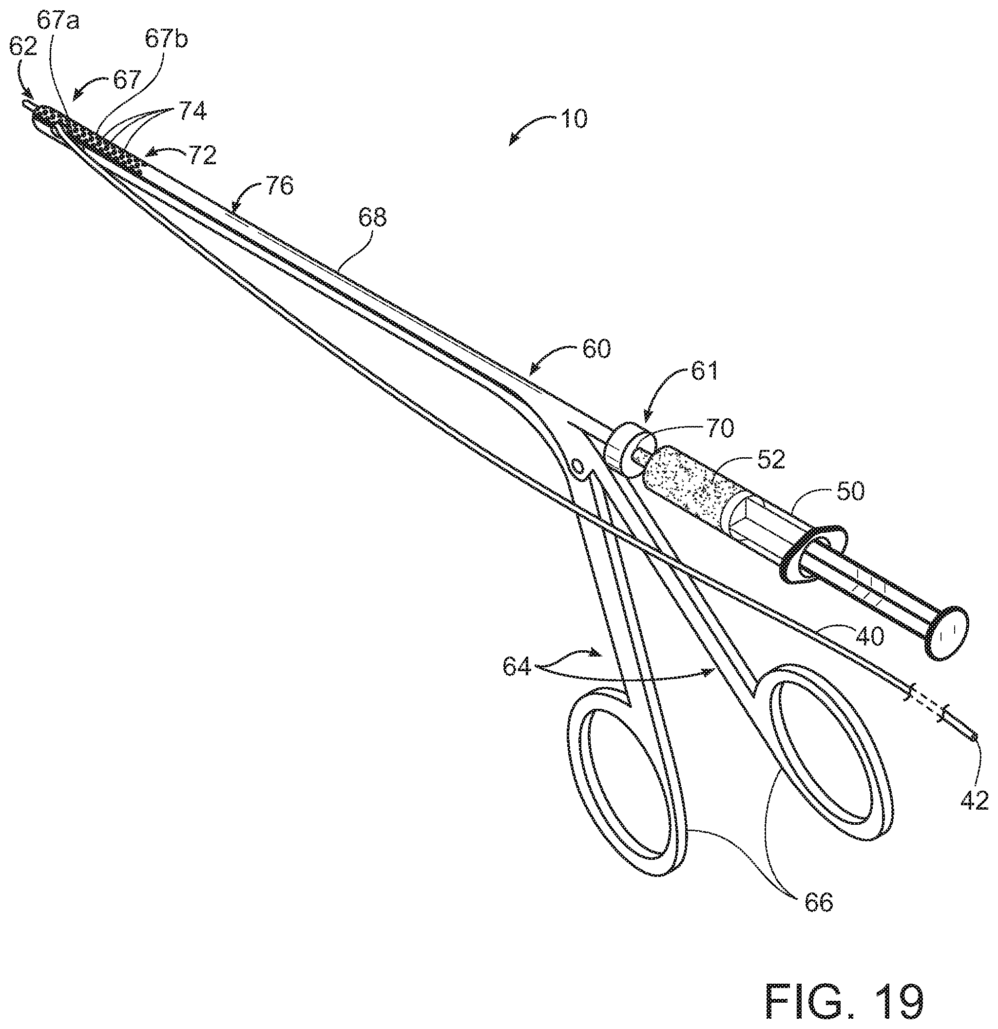 Patent US11793545 Figure 18 – Adductor canal block introducer
