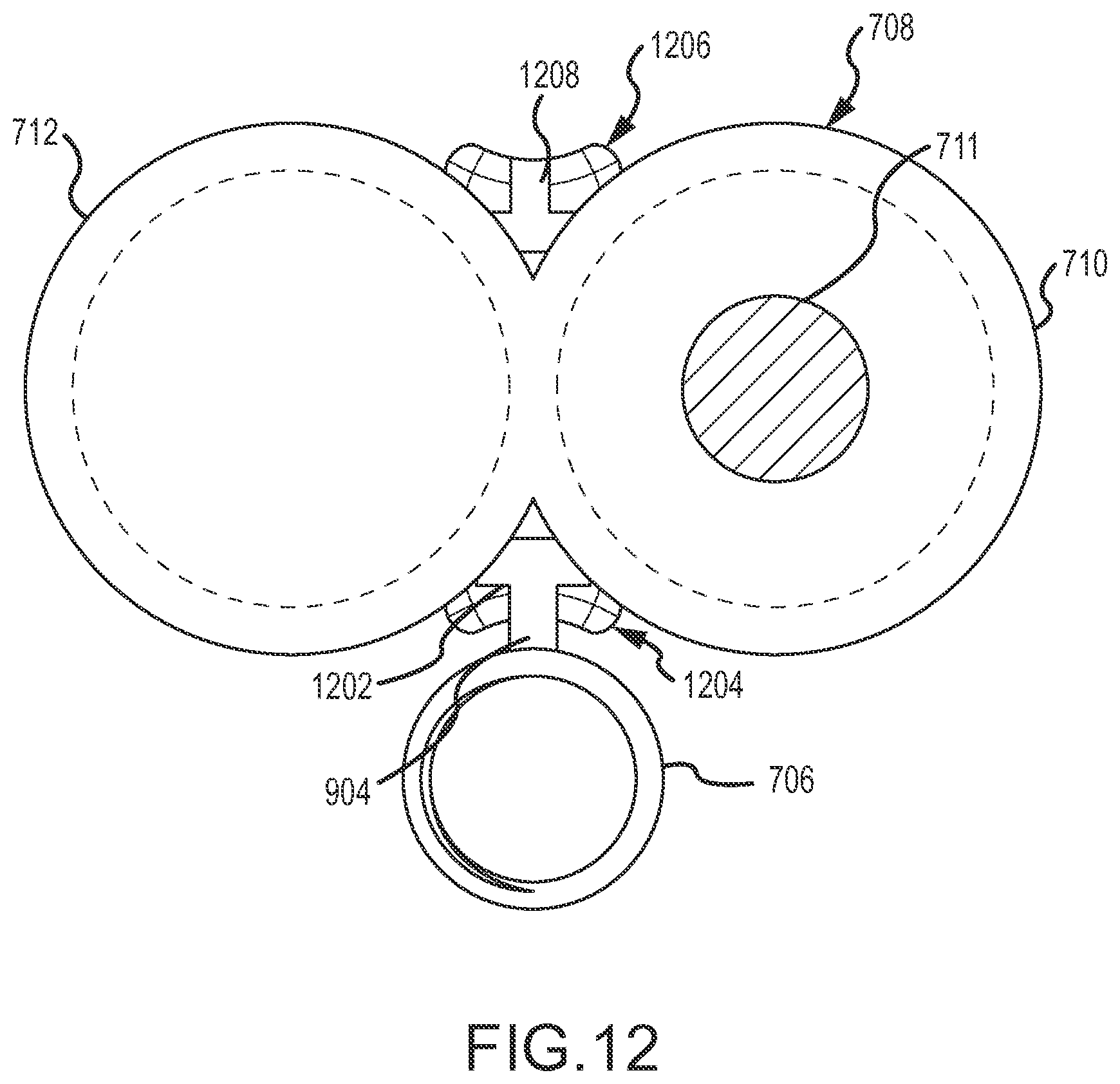 Patent US11793547 Figure 7 – Medical device, method and system thereof